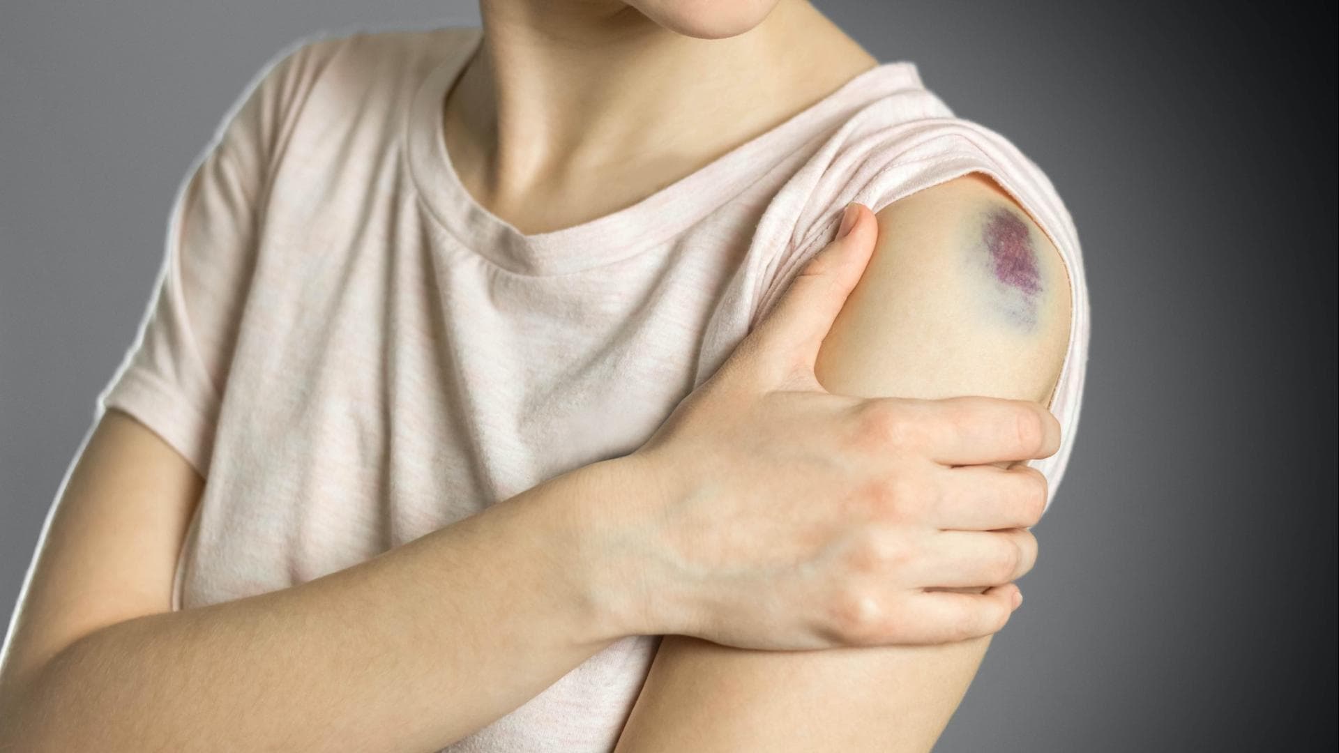 Blauer Fleck am Arm