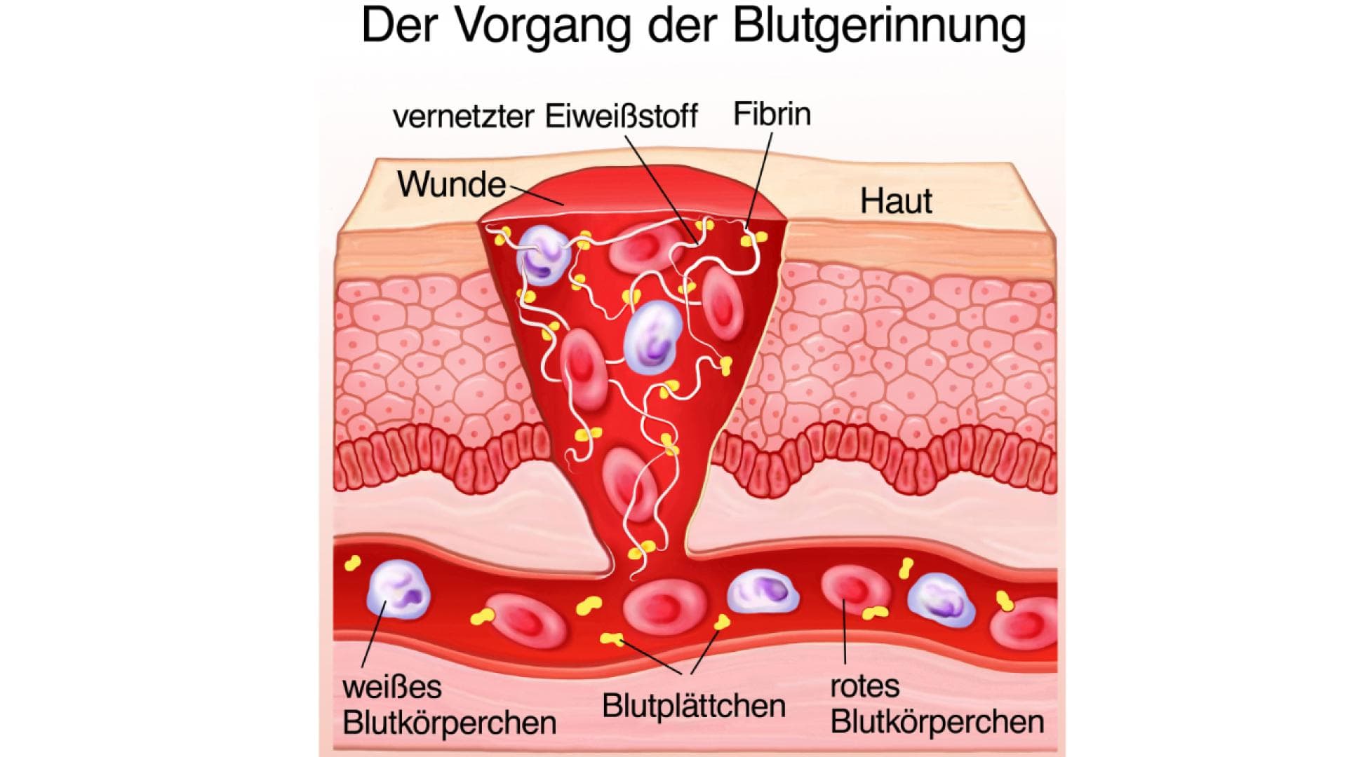 Grafik zum Vorgang der Blutgerinnung