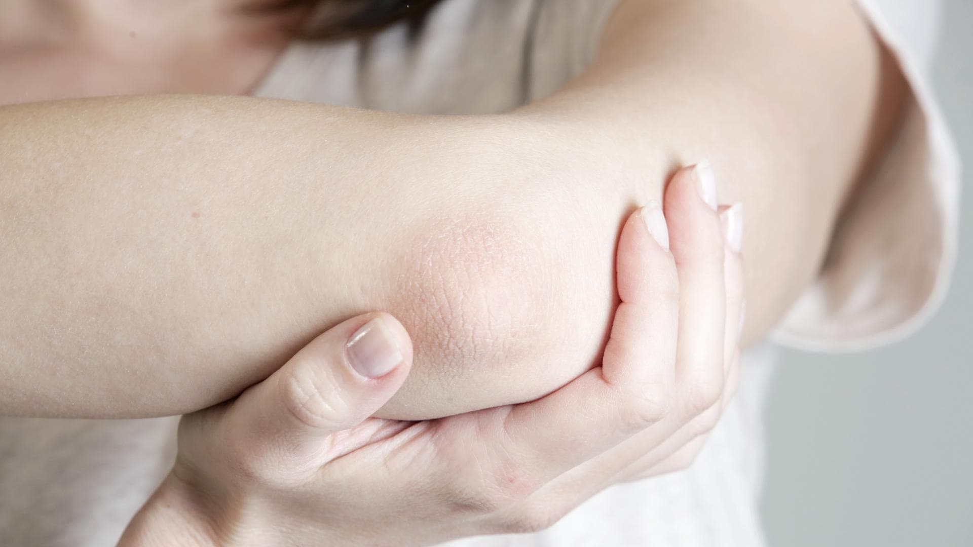Arm einer Frau