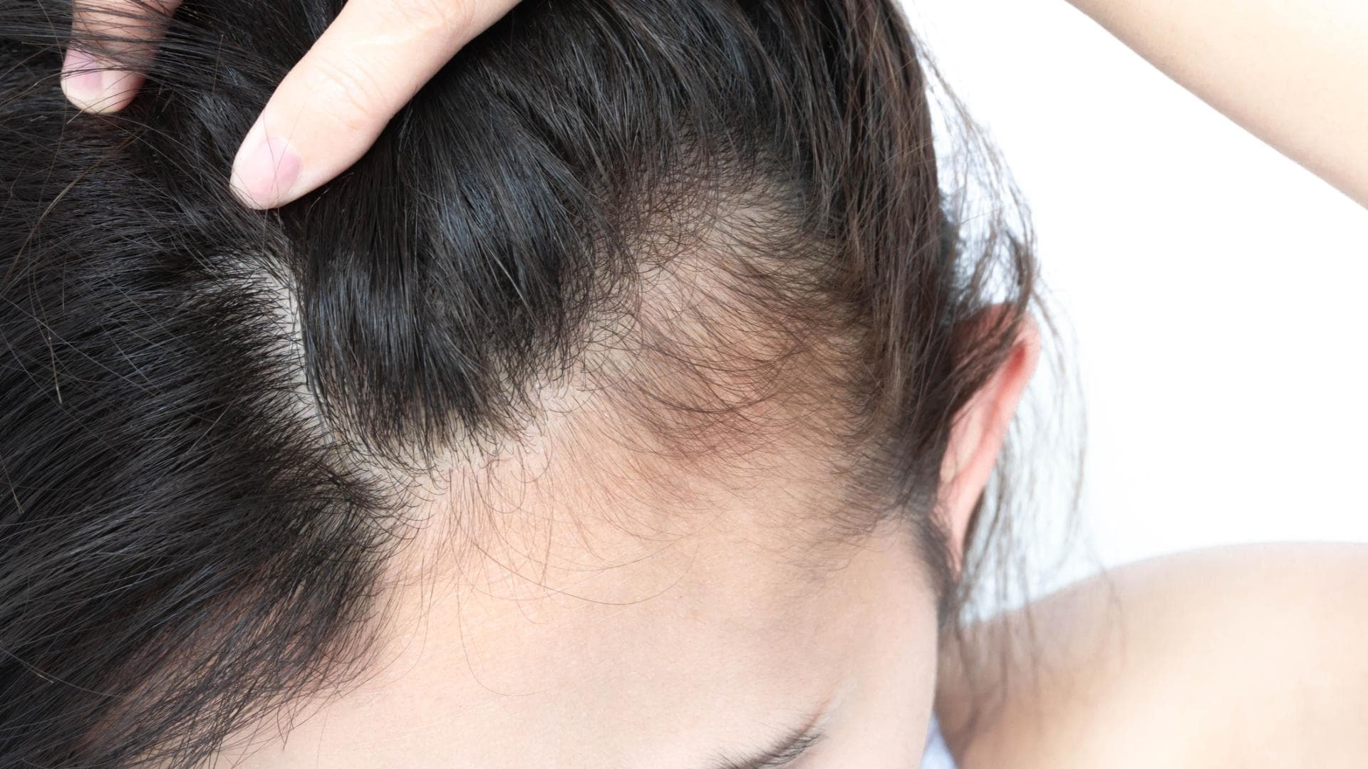 Frau mit dünnen Haaren