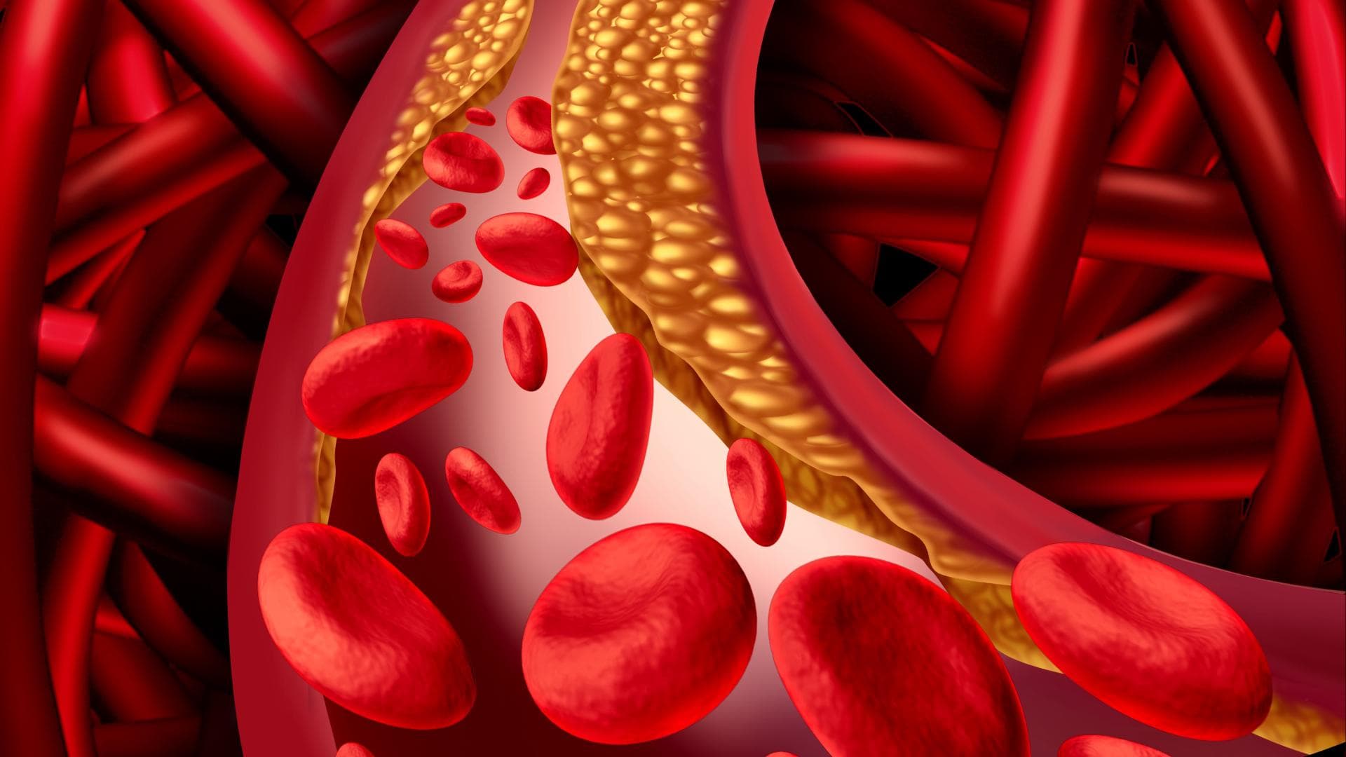 Menschen mit hohem Risiko für Herz-Kreislauf-Erkrankungen sollten ihr Cholesterin senken.