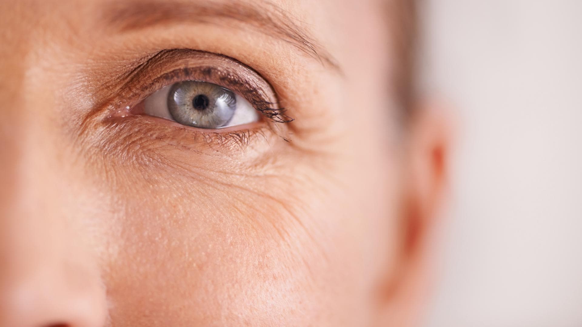 Falten am Augen