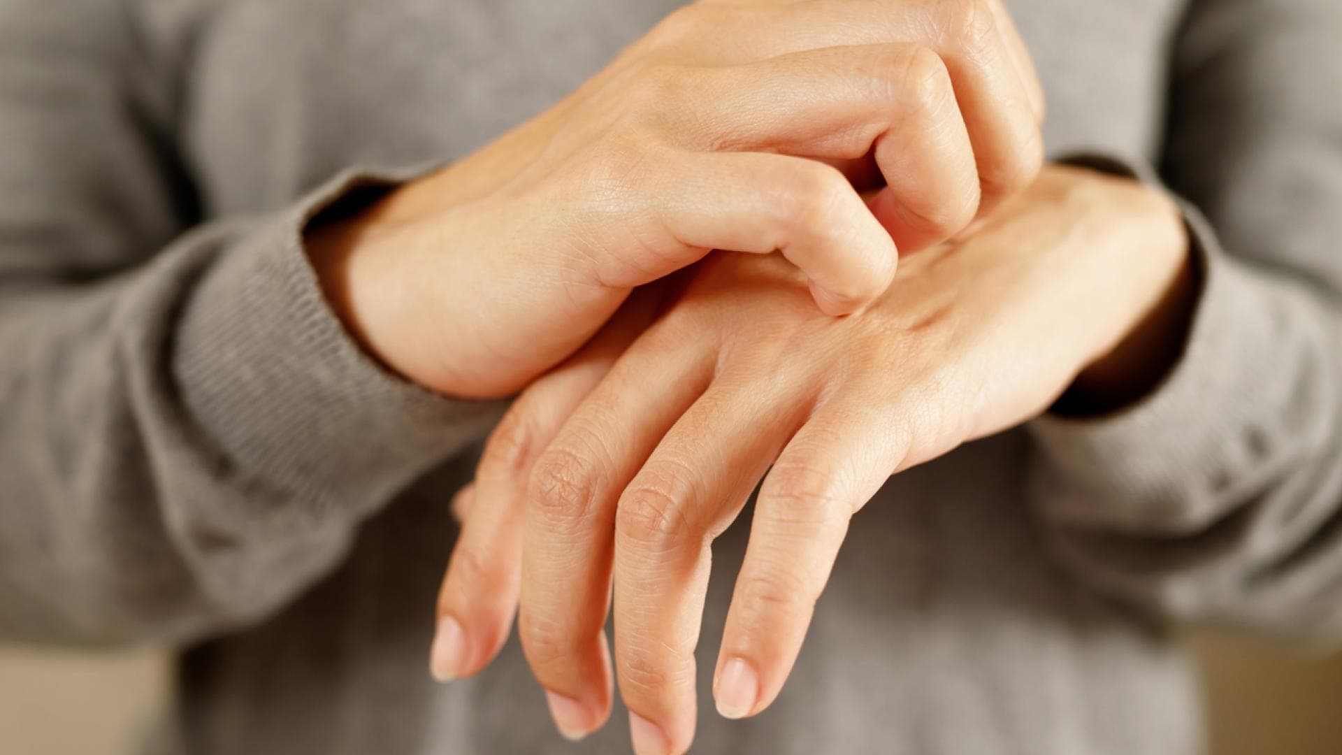 Frau juckt Handrücken