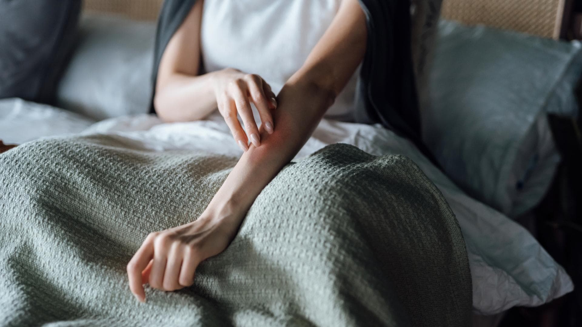 Frau mit juckendem Ausschlag am Arm