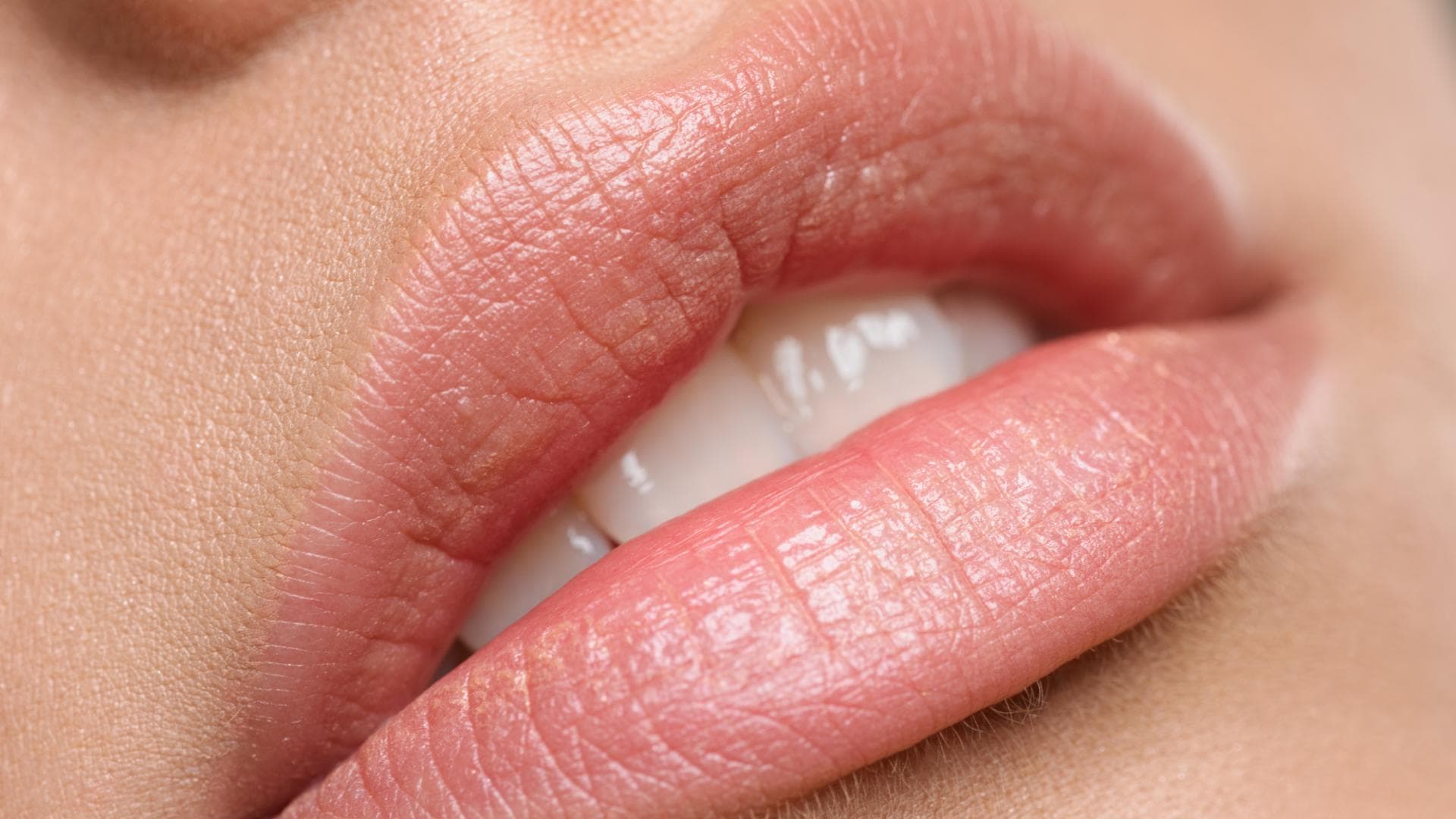 Voll Lippen