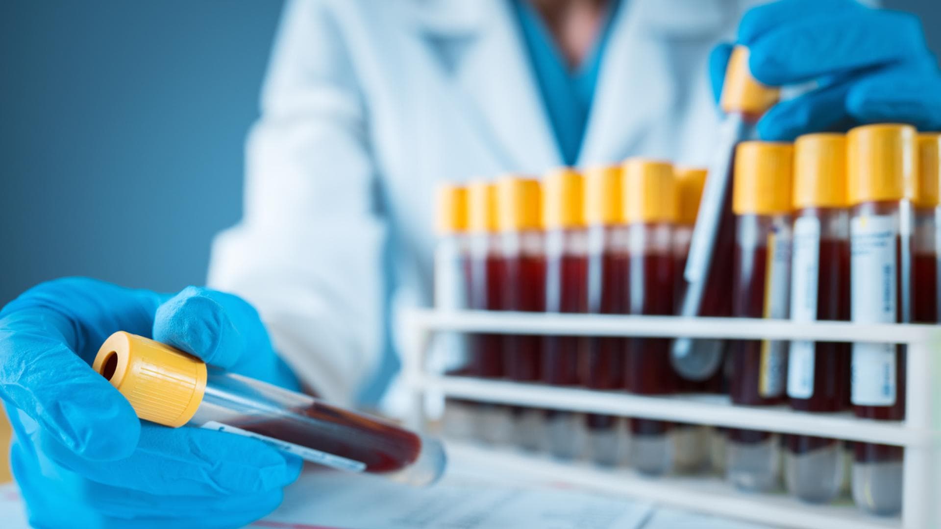 Die Behandlung von Hepatitis B zielt darauf ab, die Viruslast im Körper zu reduzieren.