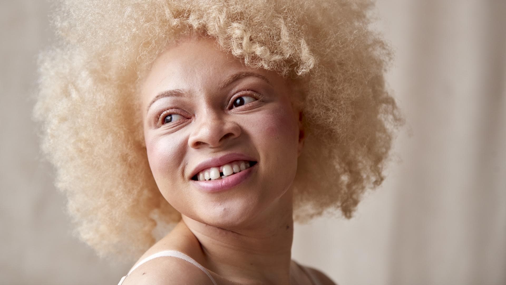 Albino Frau