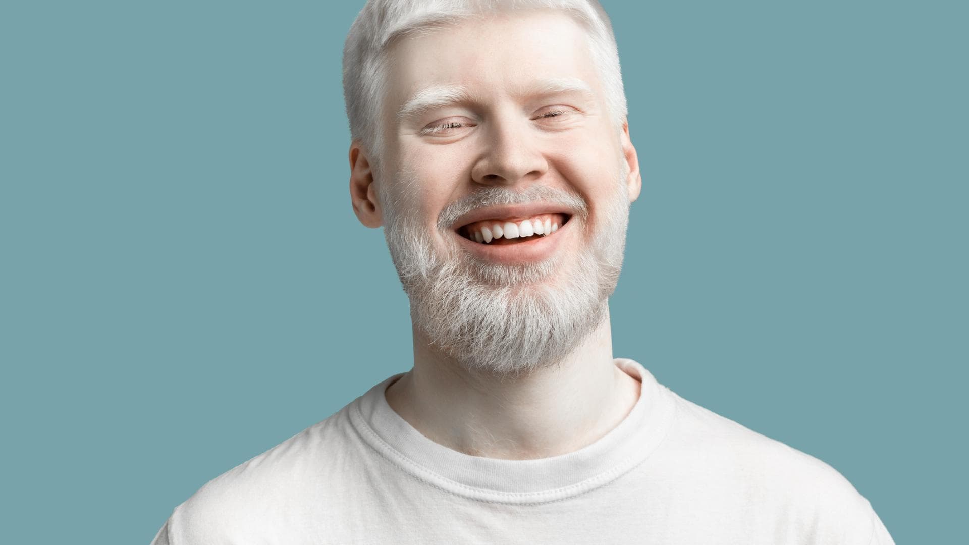 Mann mit Albinismus