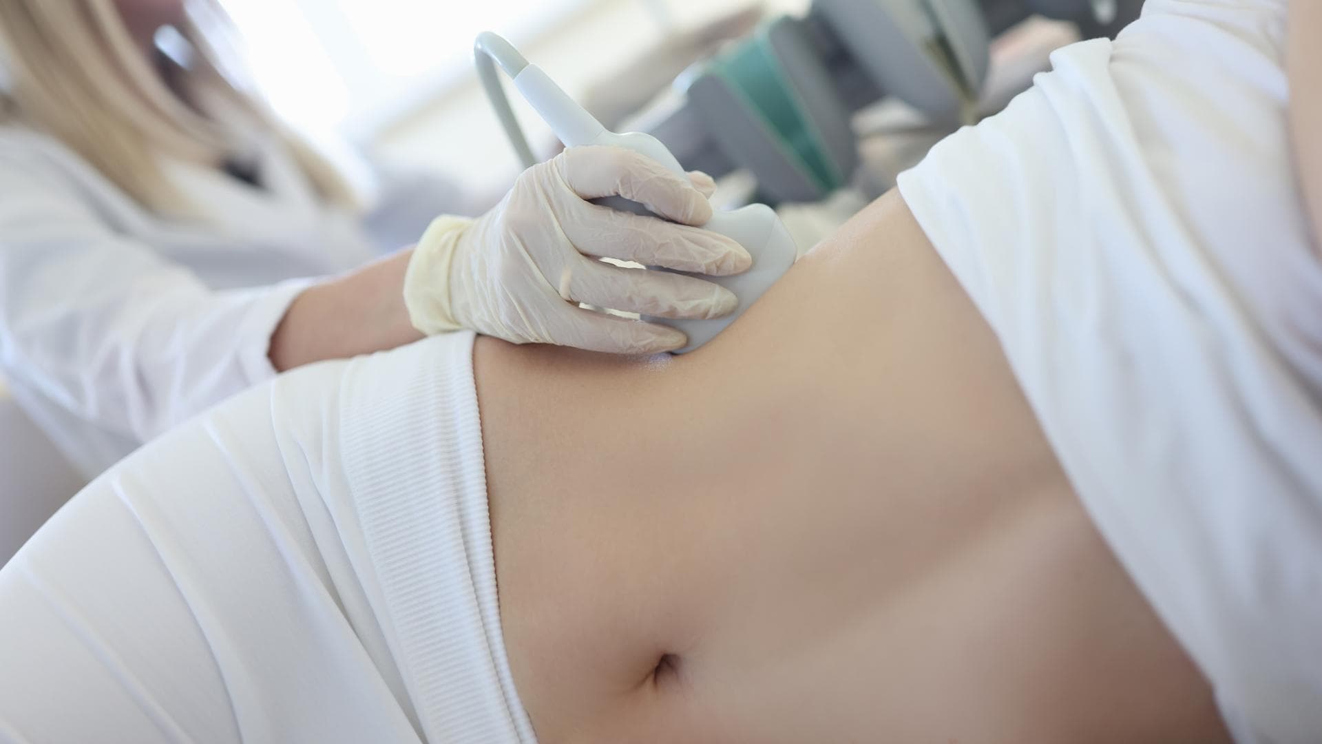 Nierentumor bei einer Patientin untersuchen