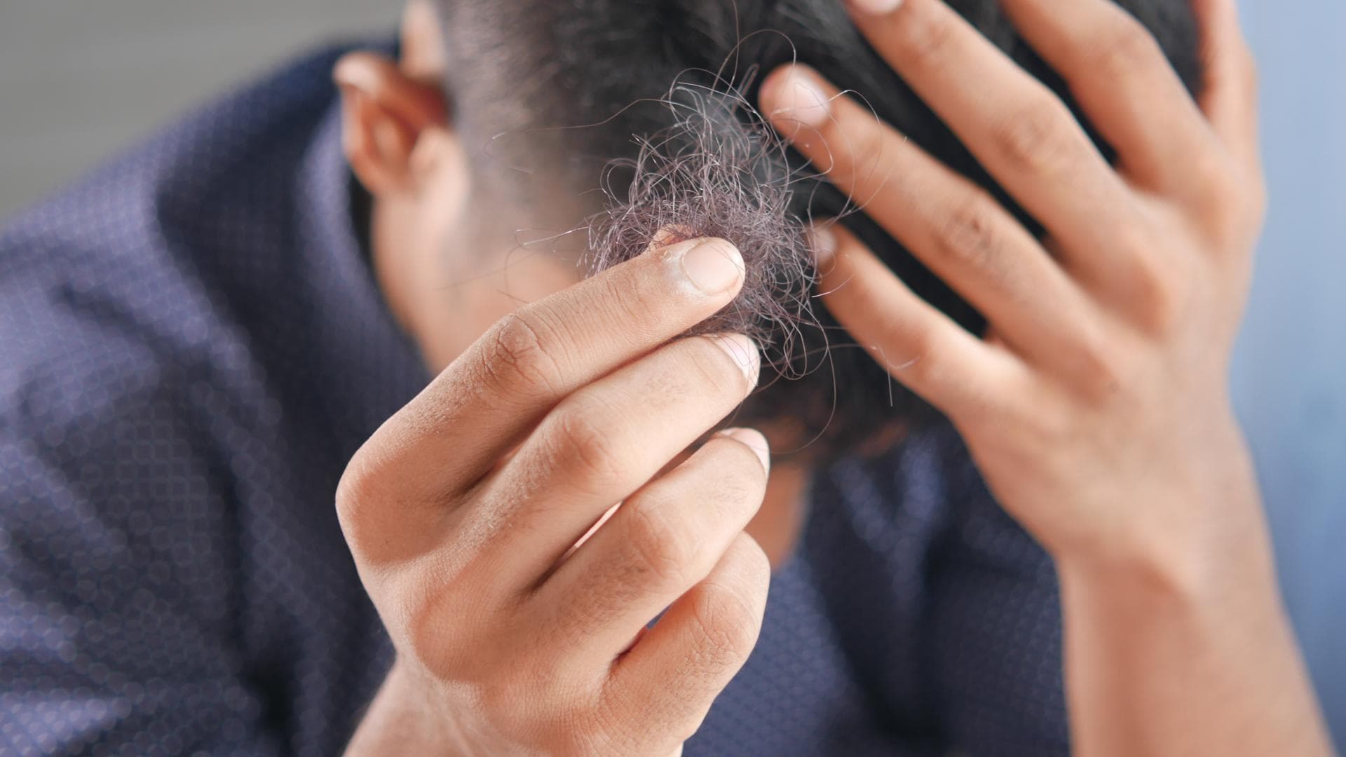 Mann hält Haarbüschel in der Hand