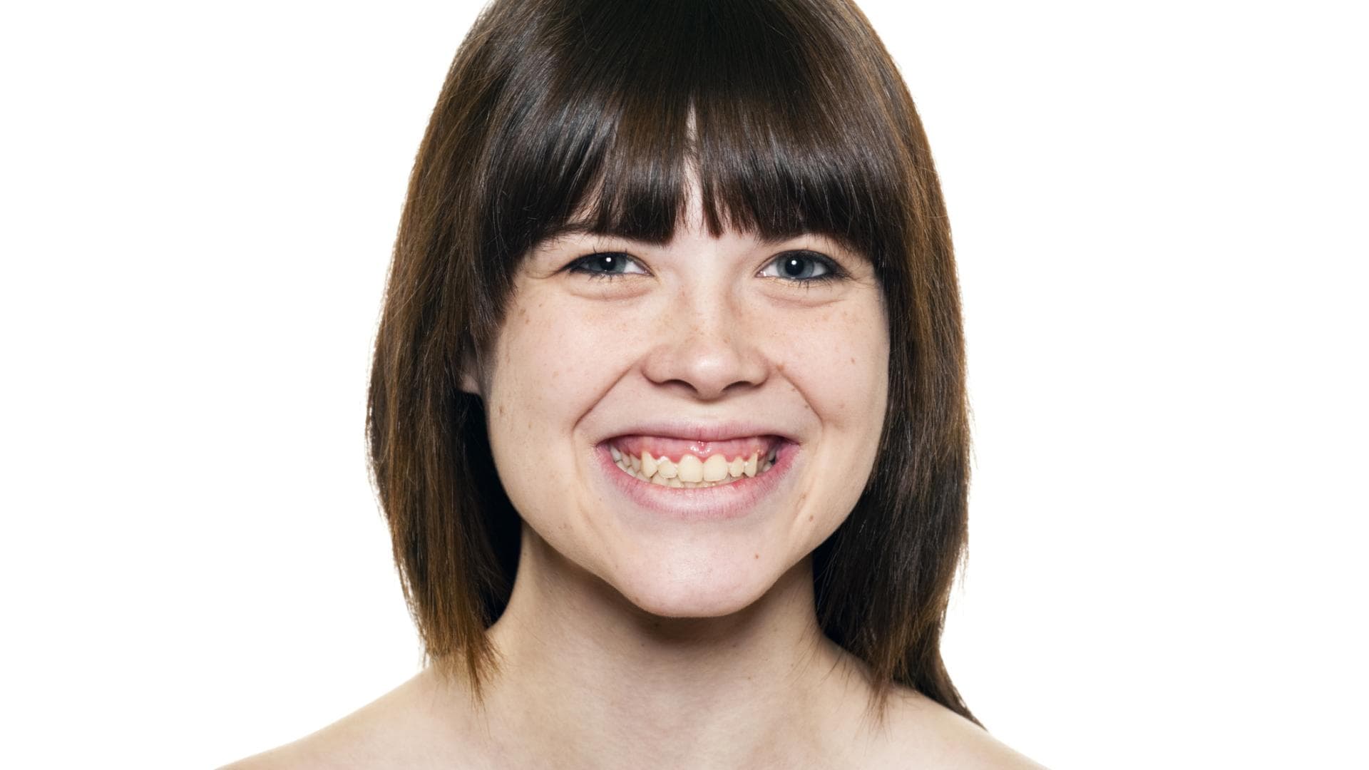 Frau mit Zahnfleischlächeln