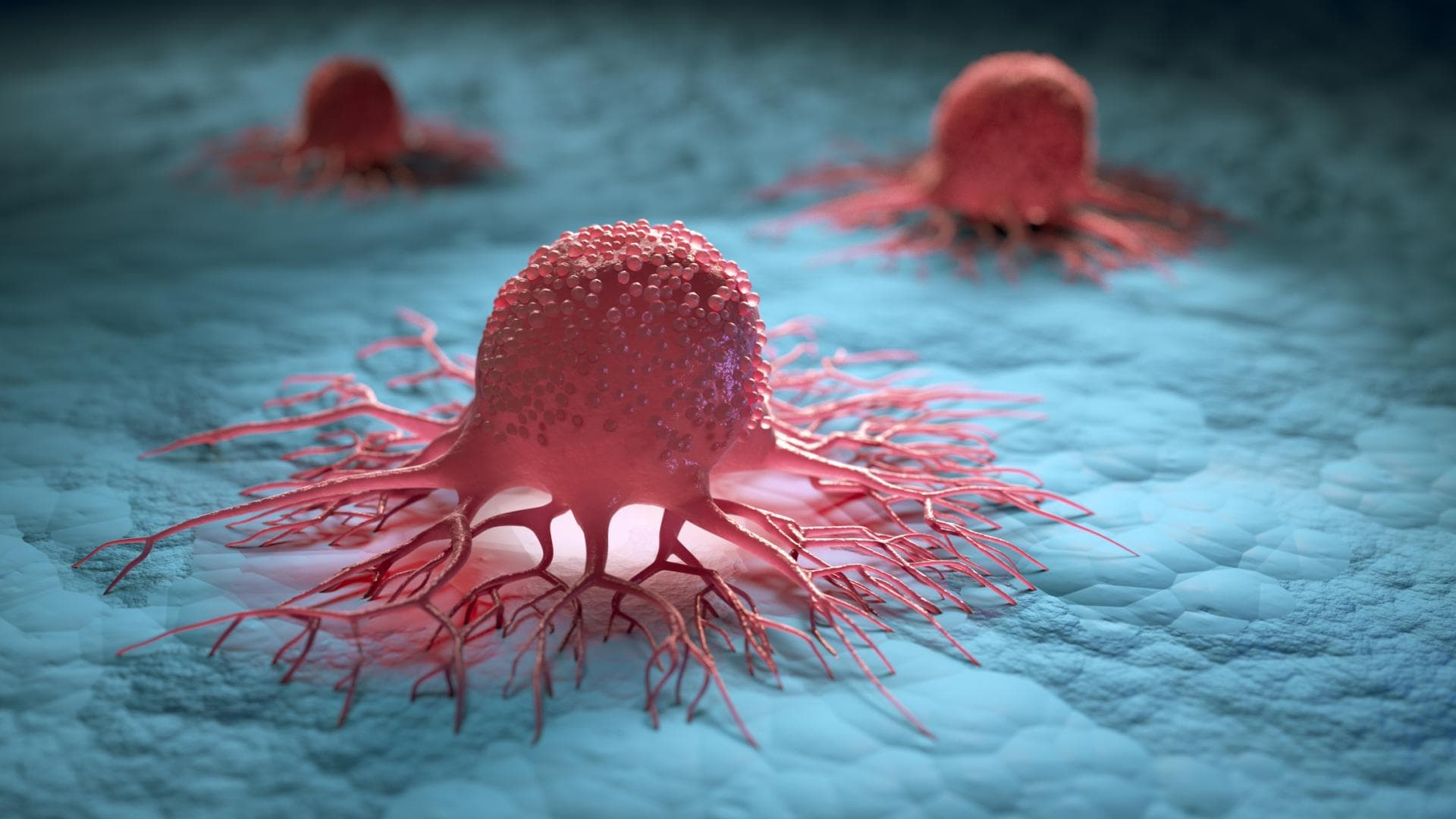 Chemotherapie und Strahlentherapie bekämpfen Darmkrebs-Zellen.