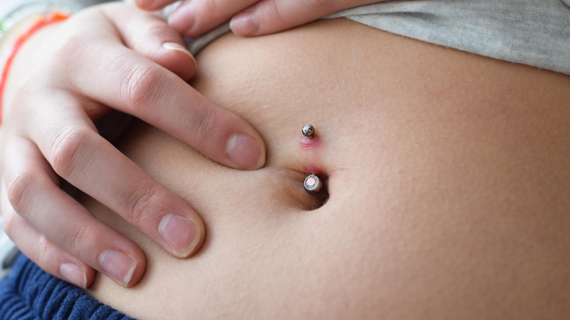 In manchen Fällen kommt es am Piercing zu sogenanntem Wildfleisch.