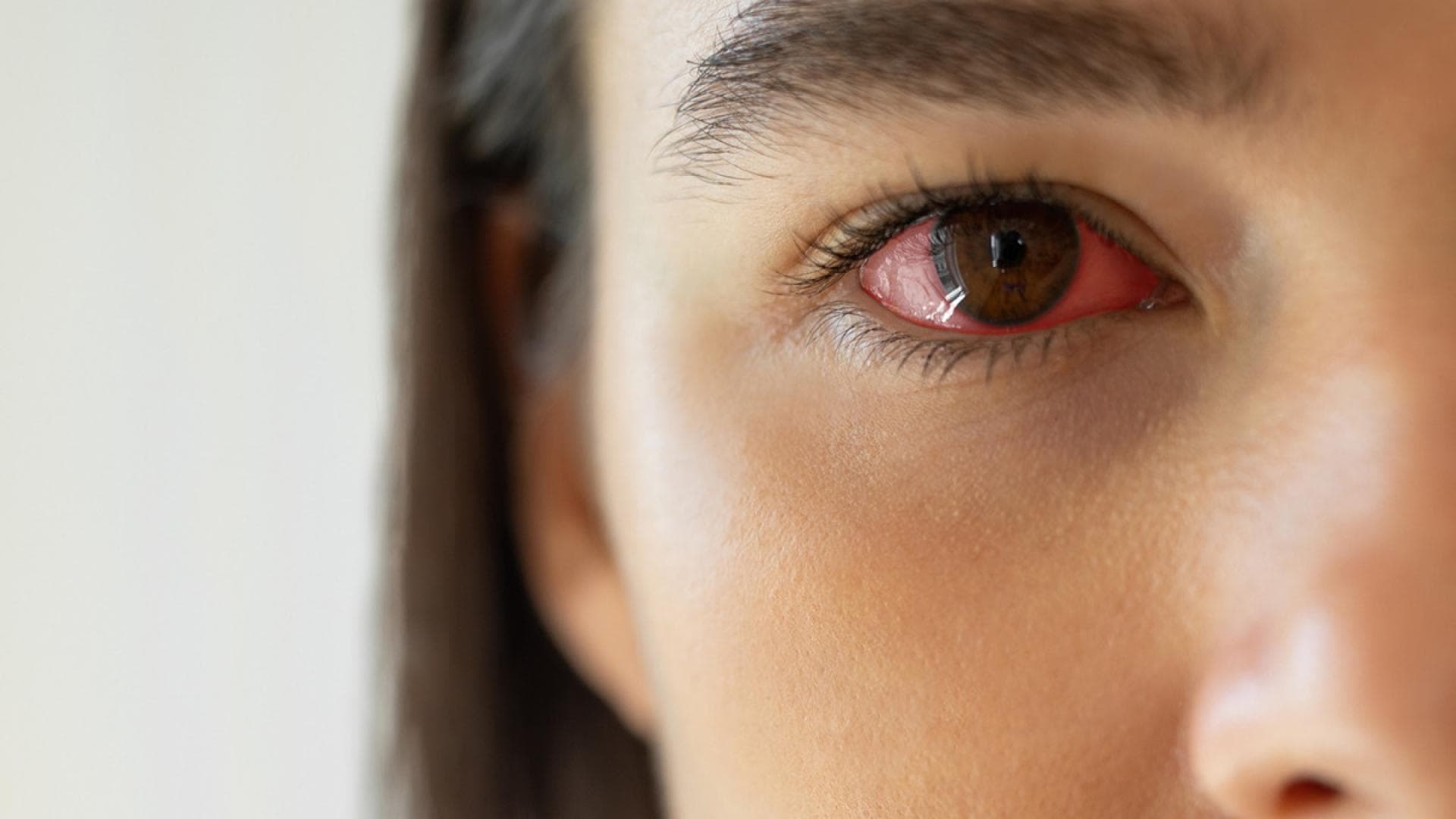 rotes Auge