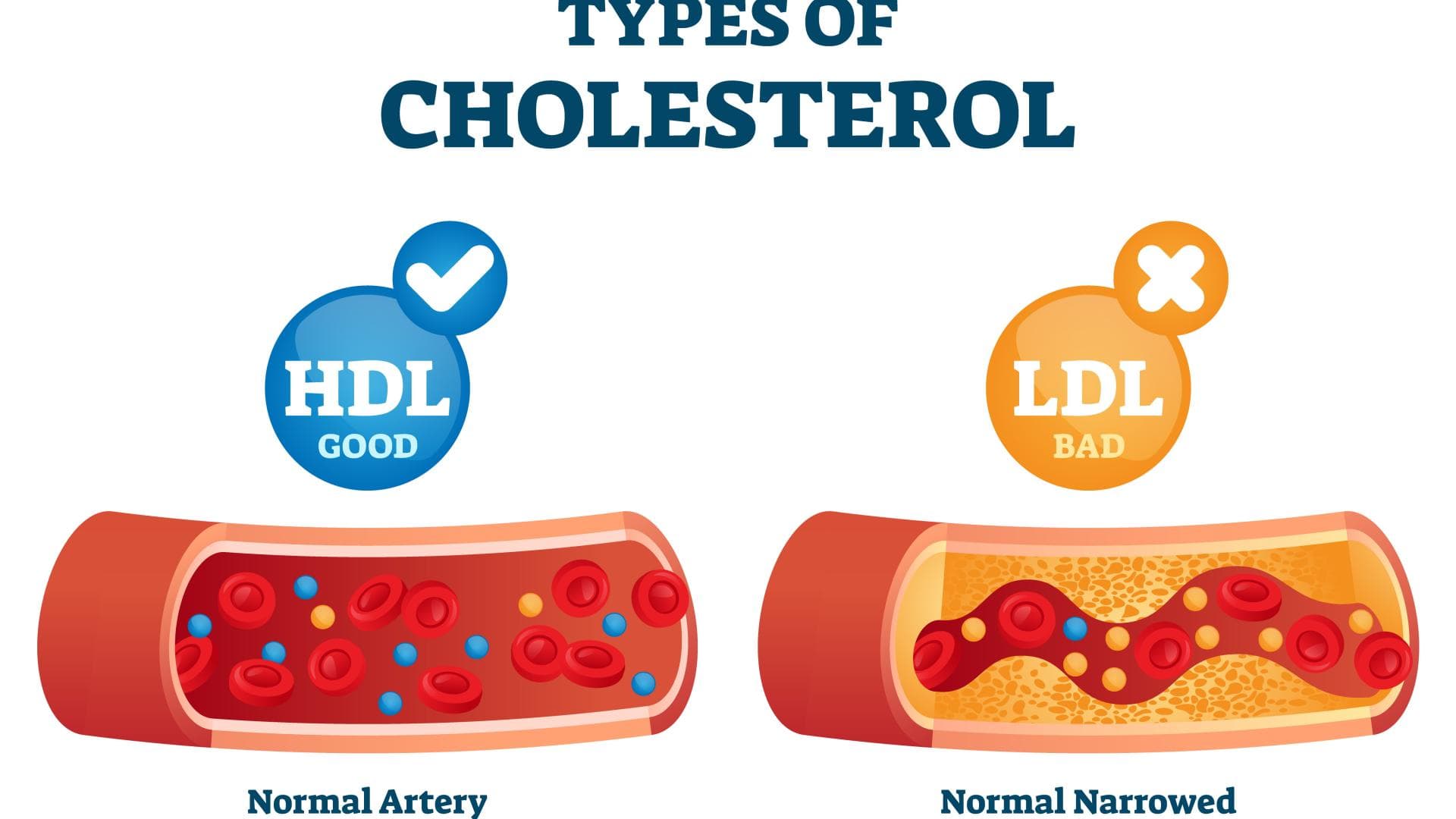 HDL Cholesterin und LDL Cholesterin im Vergleich