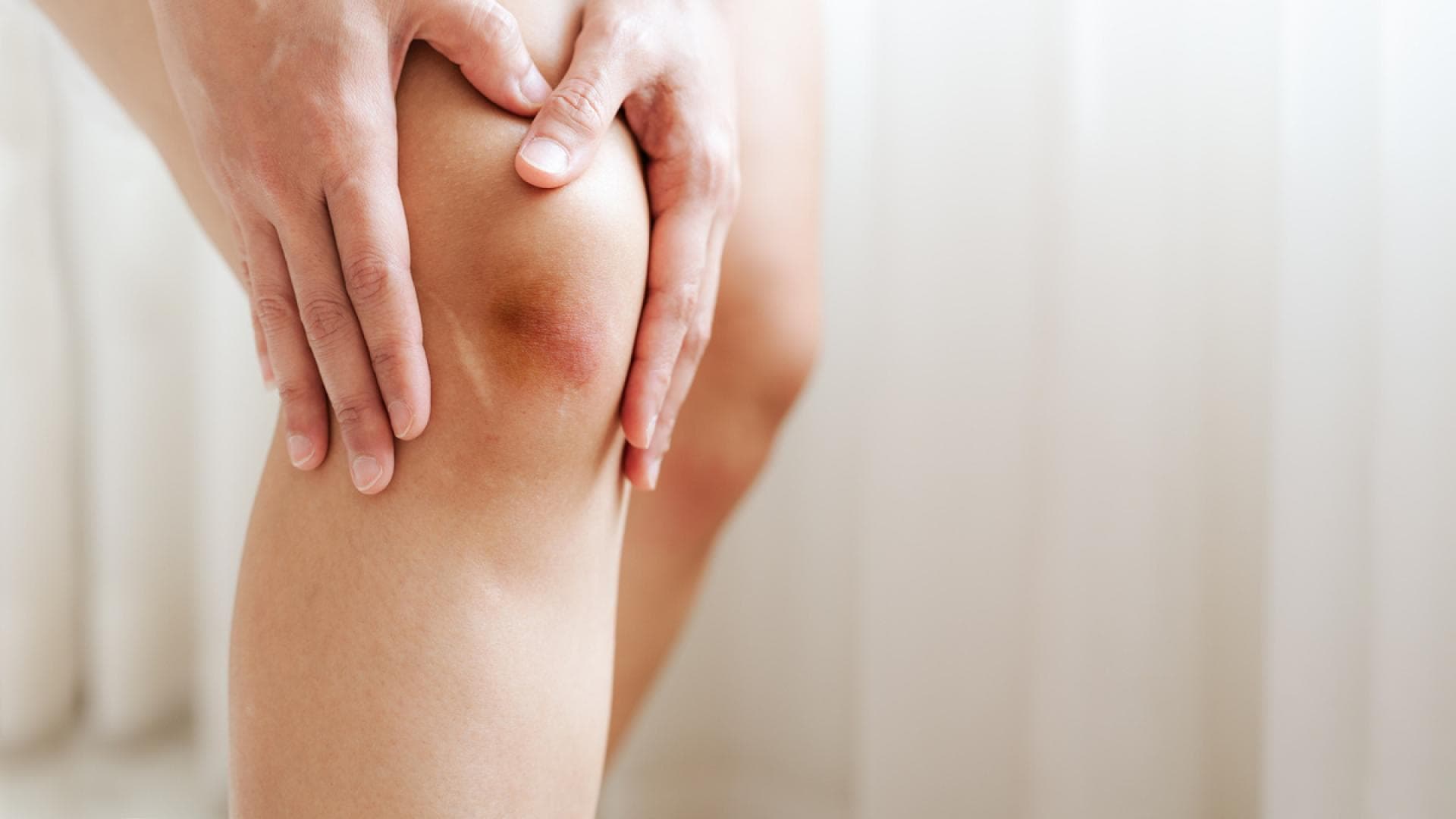 Blauer Fleck am Knie