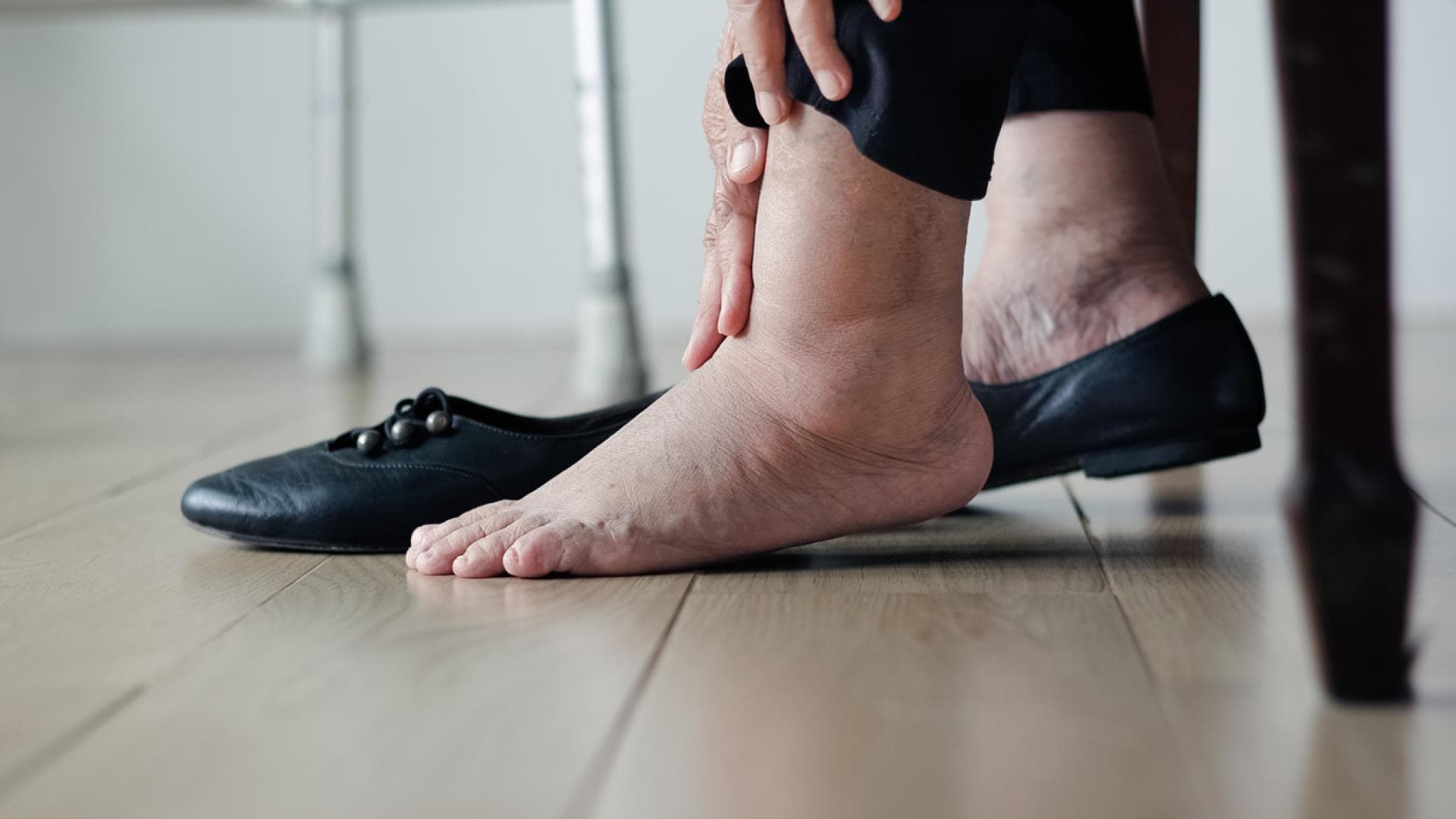 Charcot Fuß