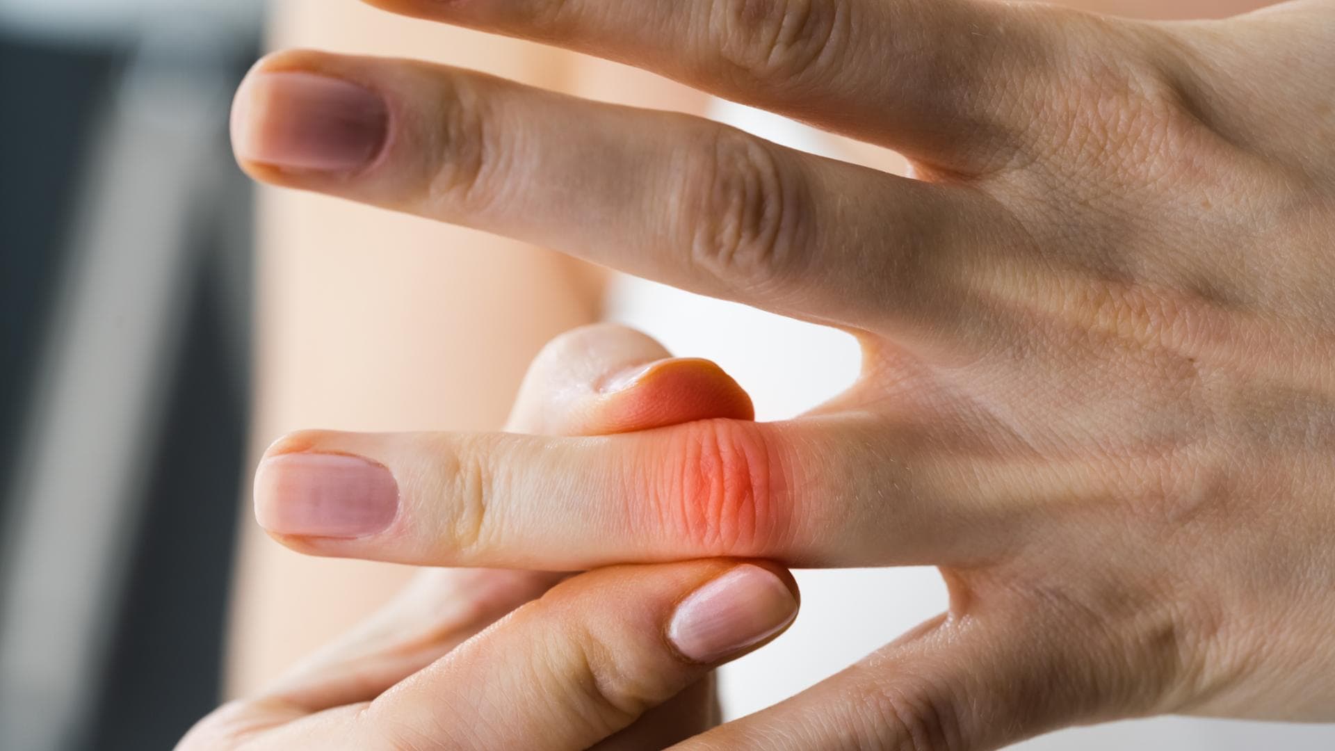 Gicht im Finger