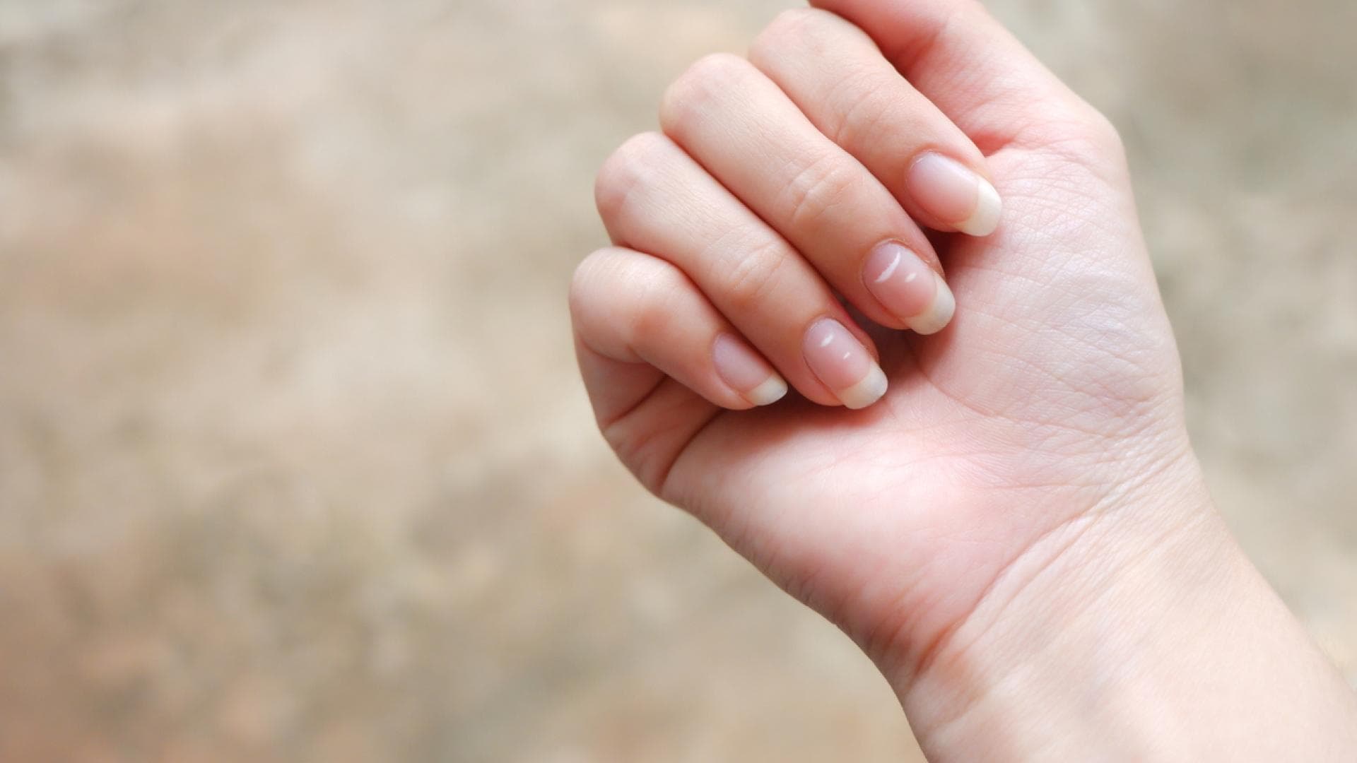 Weiße Punkte auf Fingernägeln Mögliche Ursachen