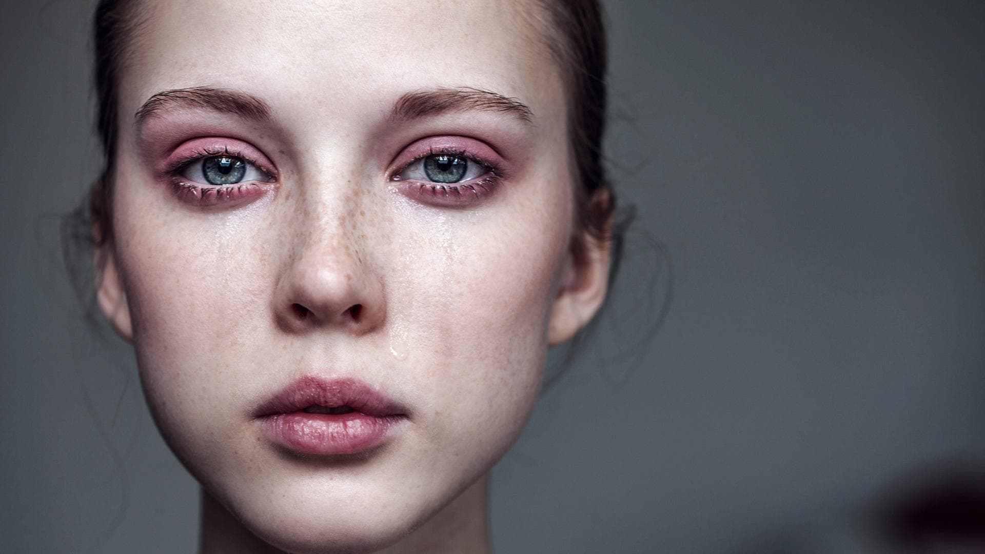 Geschwollene Augen nach Weinen Geschwollene Augen nach Weinen