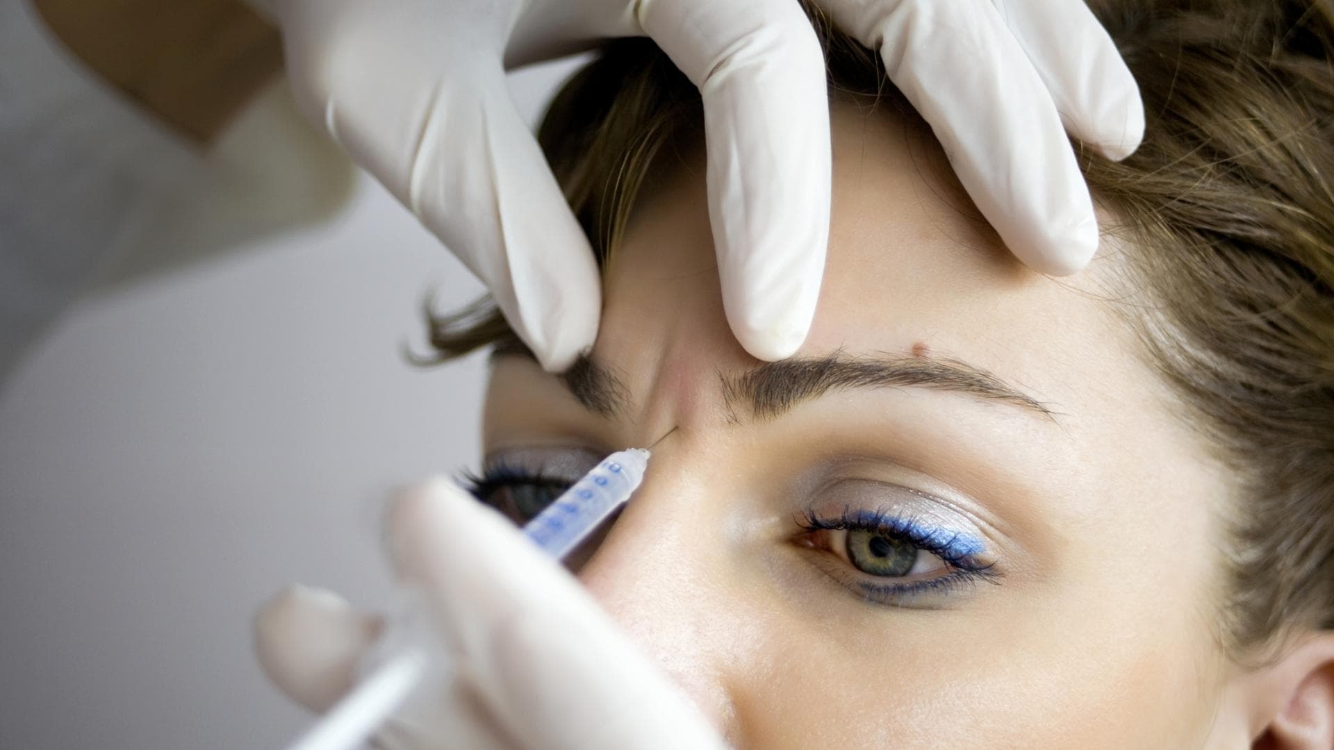 Unterspritzung einer Zornesfalte mit Botox Unterspritzung einer Zornesfalte mit Botox