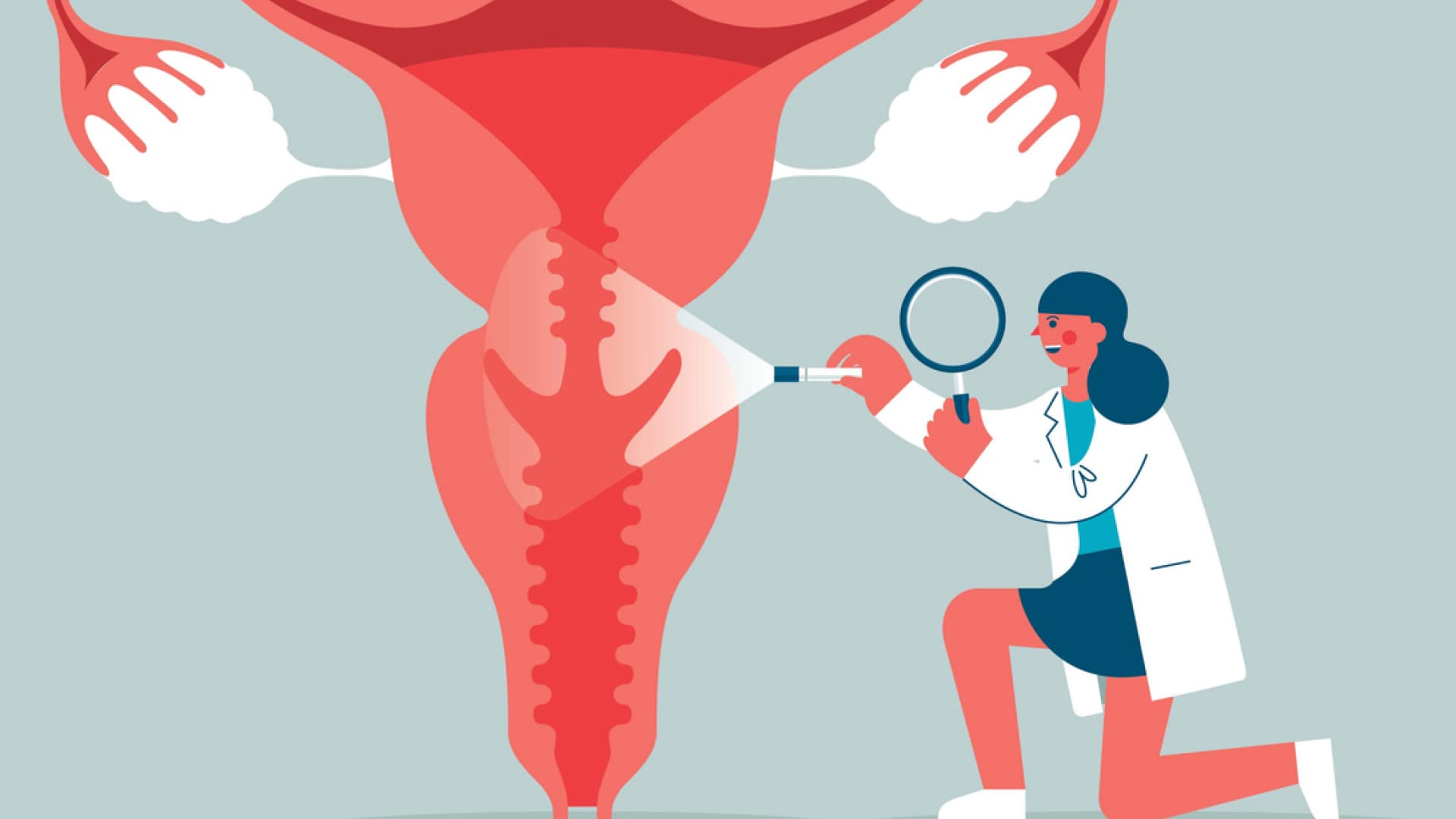 Bei einer Endometriose siedelt sich Gewebe außerhalb der Gebärmutterhöhle ansiedelt. Bei einer Endometriose siedelt sich Gewebe außerhalb der Gebärmutterhöhle ansiedelt.