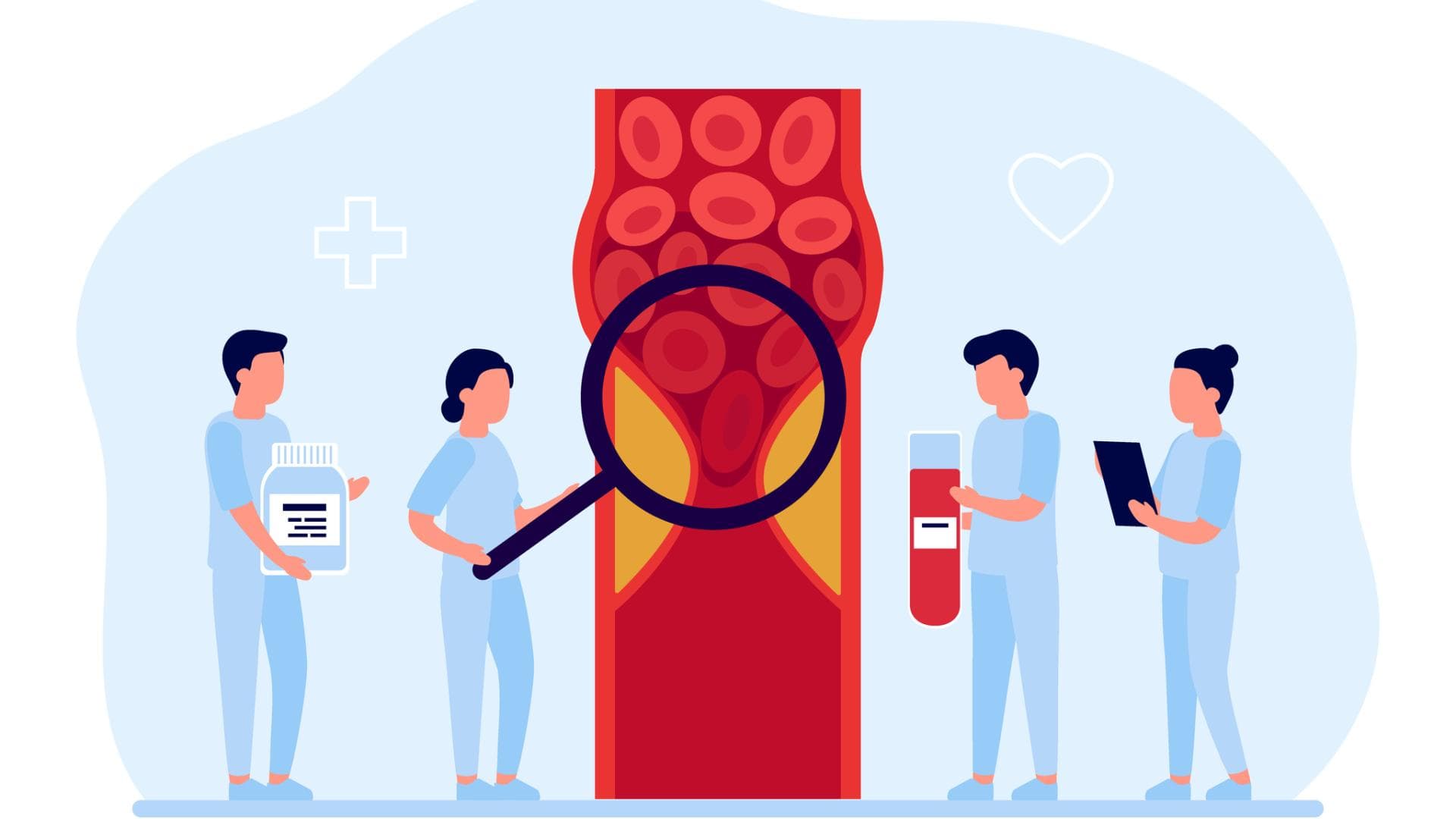 Grafik von Medizinern, die eine Thrombose untersuchen 