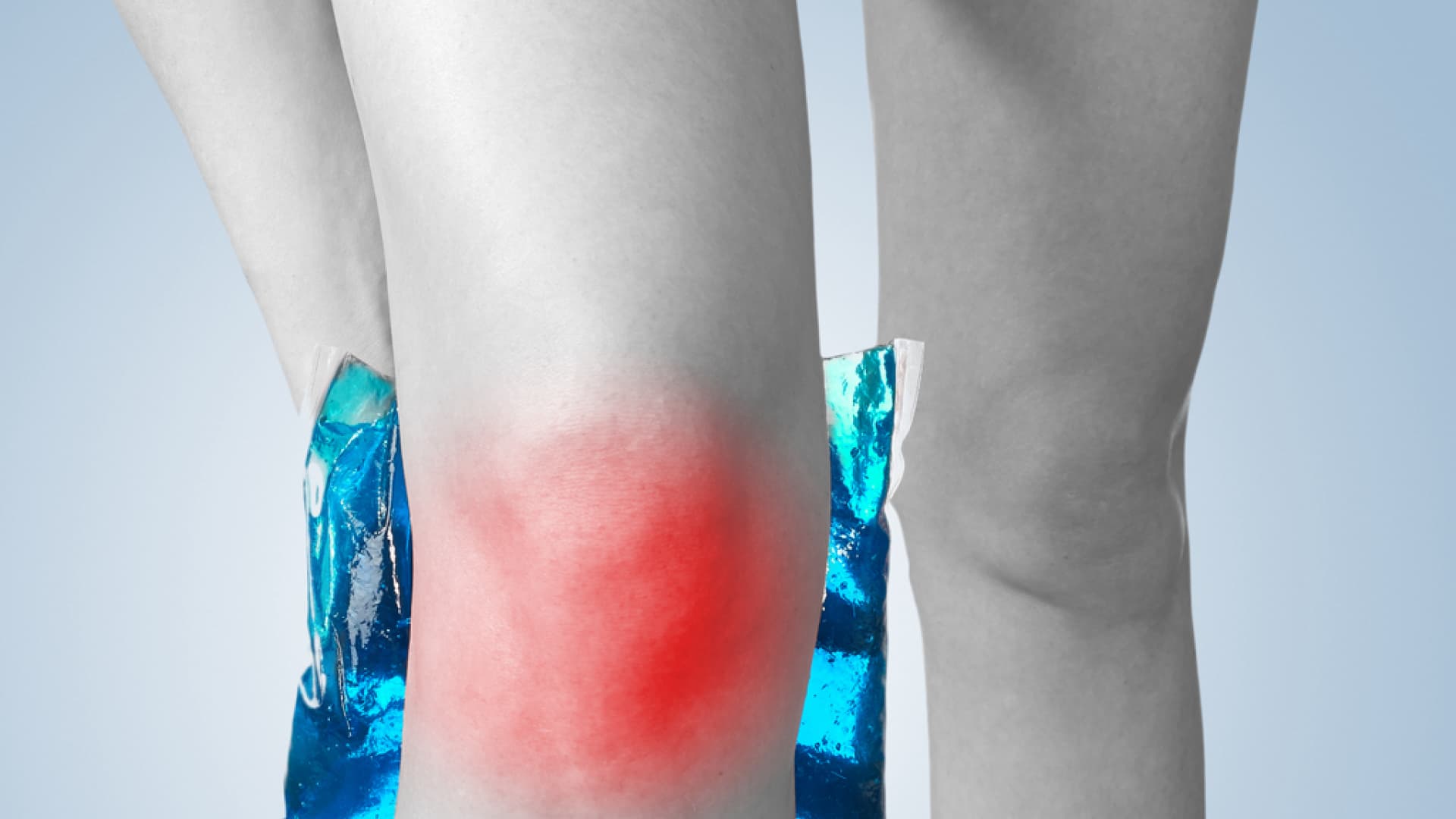 Eine frühzeitige Diagnose bei einer Bakerzyste am Knie ist wichtig, um Komplikationen zu vermeiden. Eine frühzeitige Diagnose bei einer Bakerzyste am Knie ist wichtig, um Komplikationen zu vermeiden.