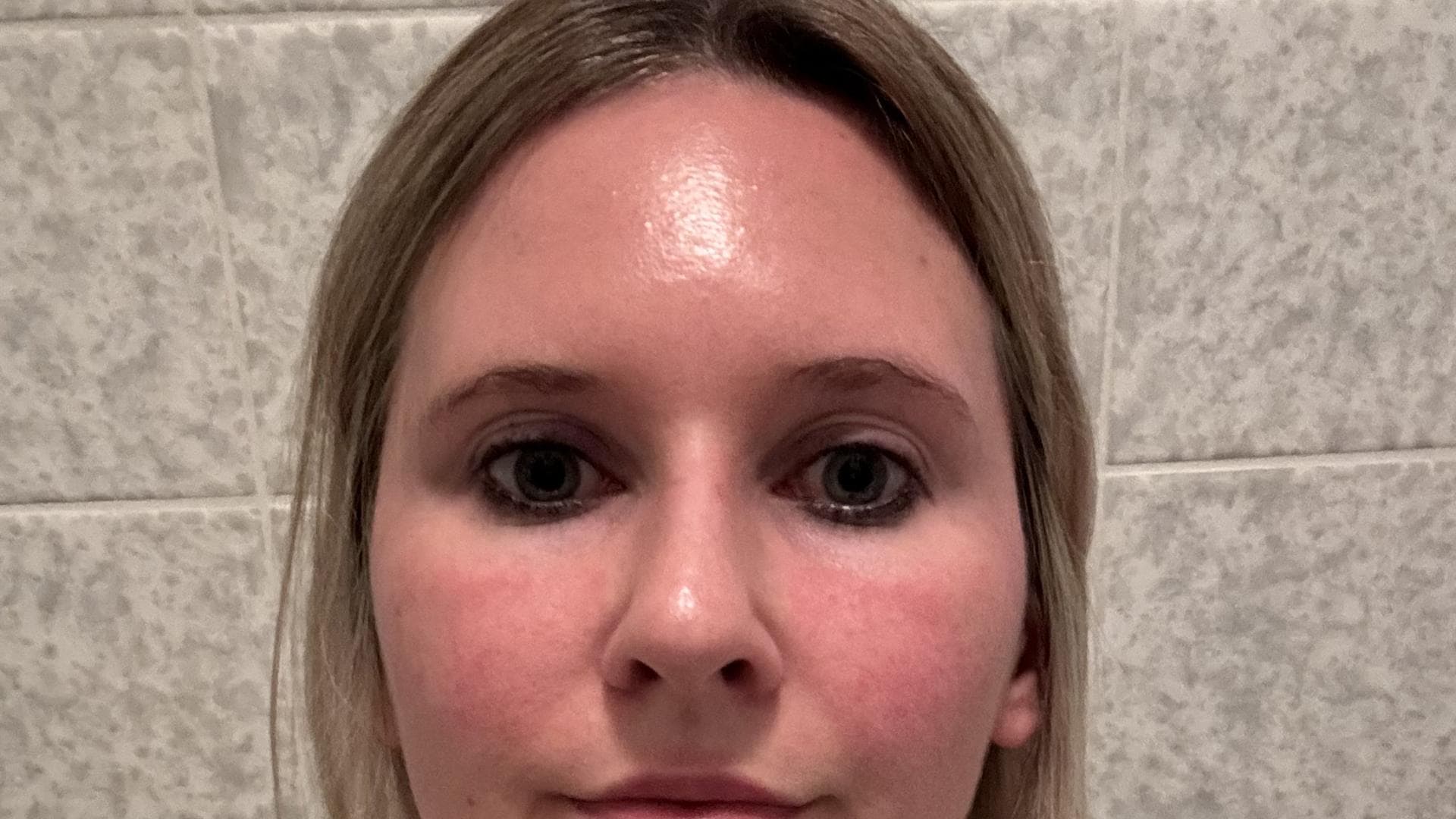 Gesicht vor der Gua Sha Massage Gesicht vor der Gua Sha Massage