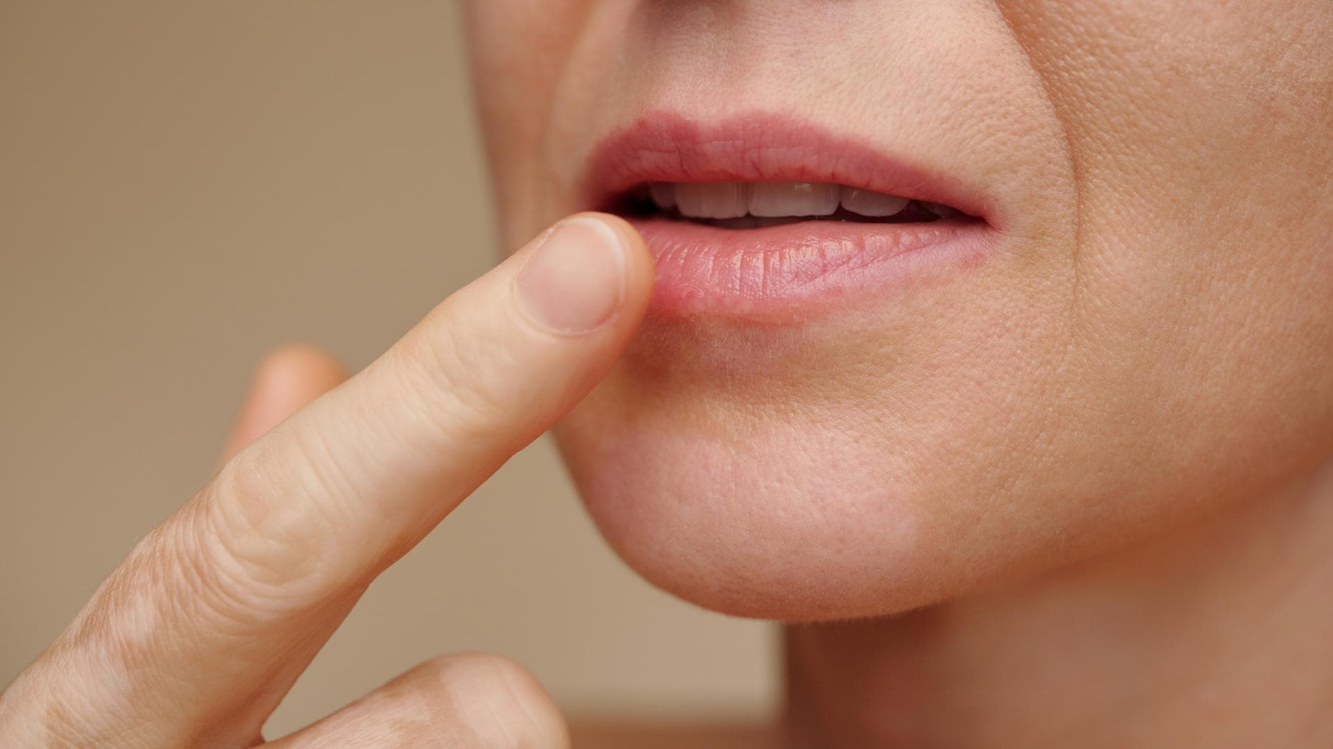 Frau fasst mit dem Finger an ihre Lippe
