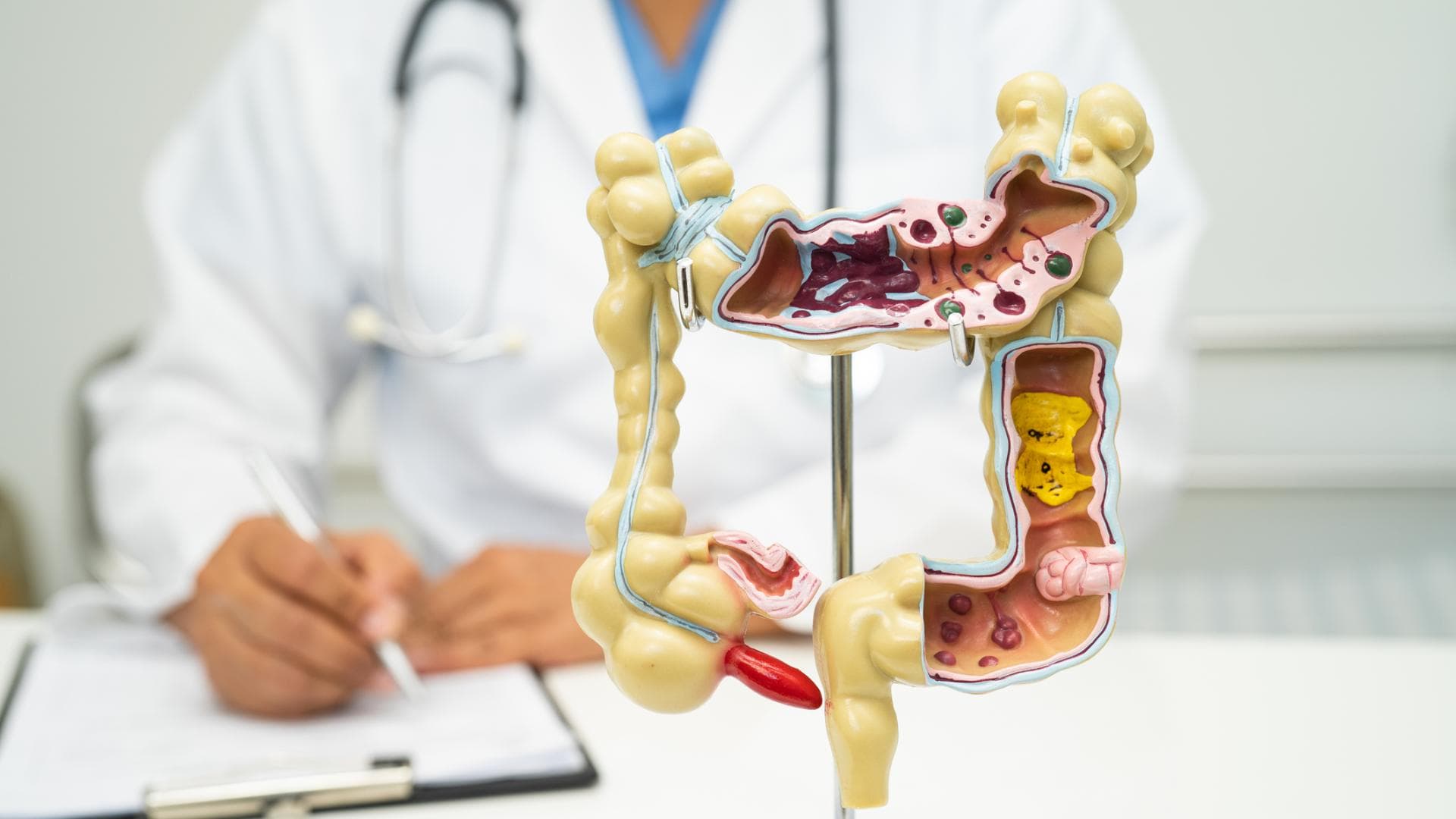 Arzt sitzt vor anatomischem Modell des Darms Arzt sitzt vor anatomischem Modell des Darms