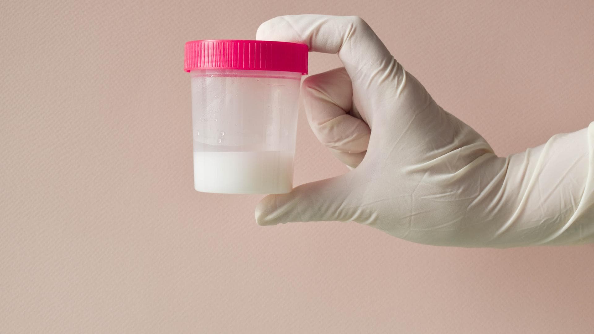 Hand hält Spermaprobe hoch Hand hält Spermaprobe hoch
