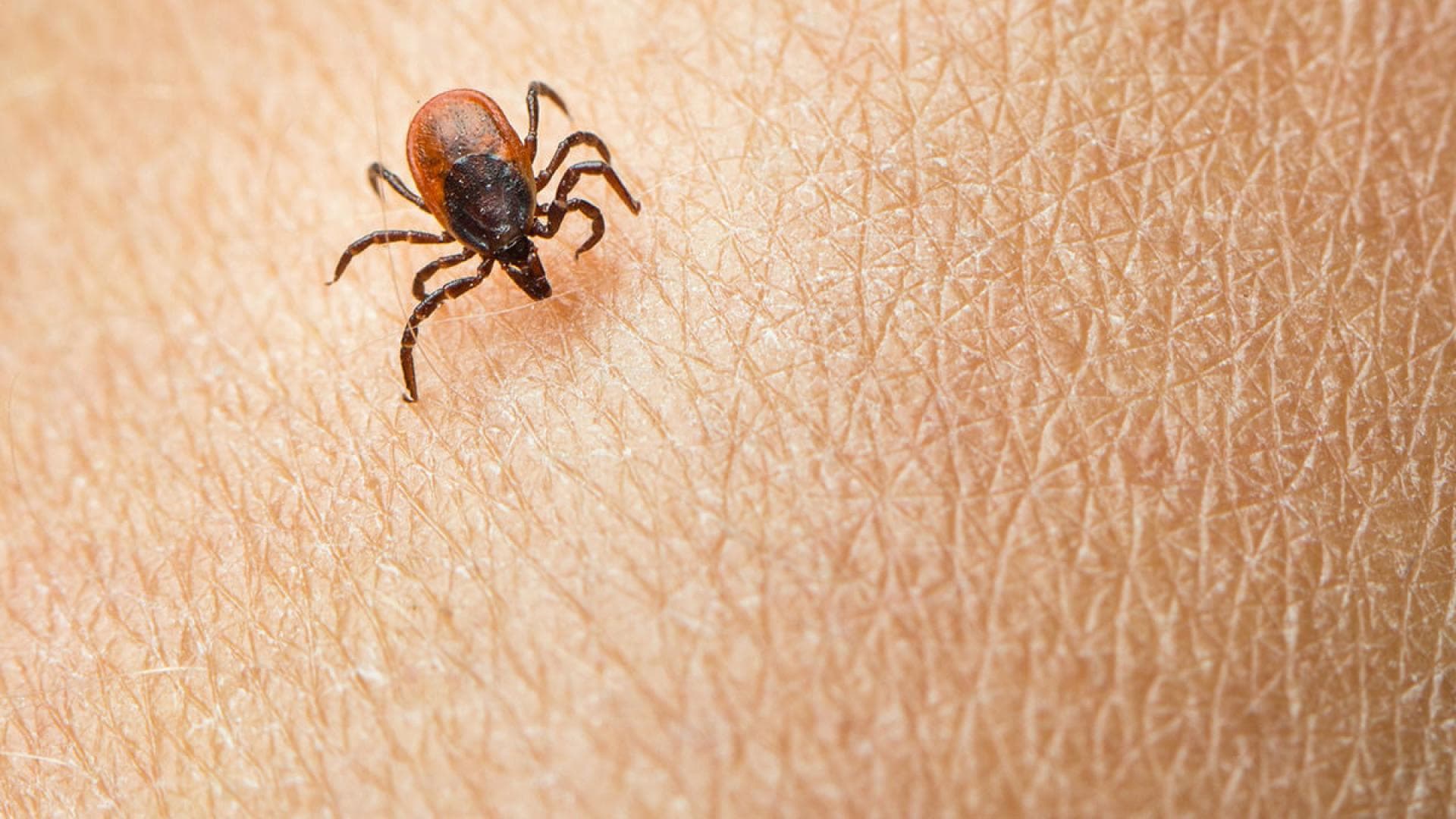 Borreliose vom Biss der Zecke Borreliose vom Biss der Zecke