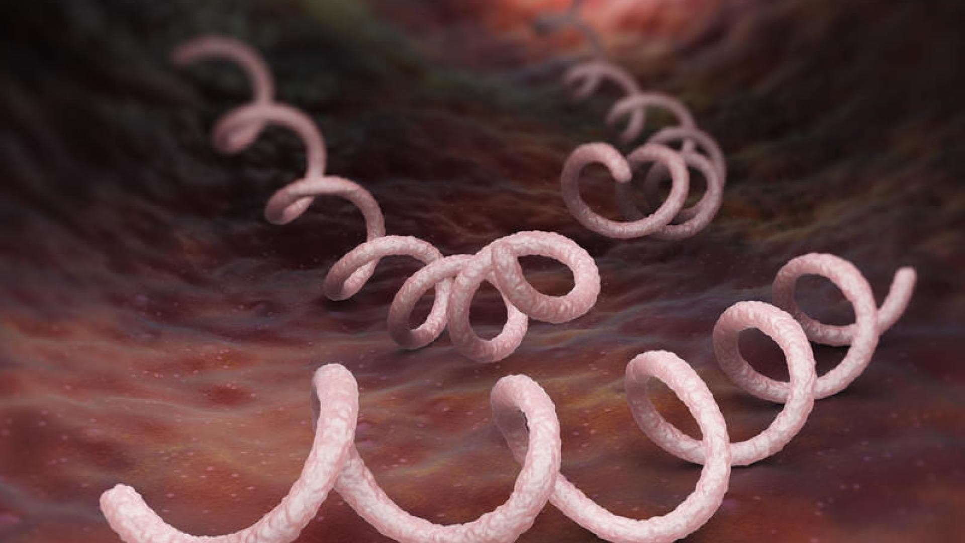 Syphilis-Erreger Syphilis-Erreger Treponema pallidum