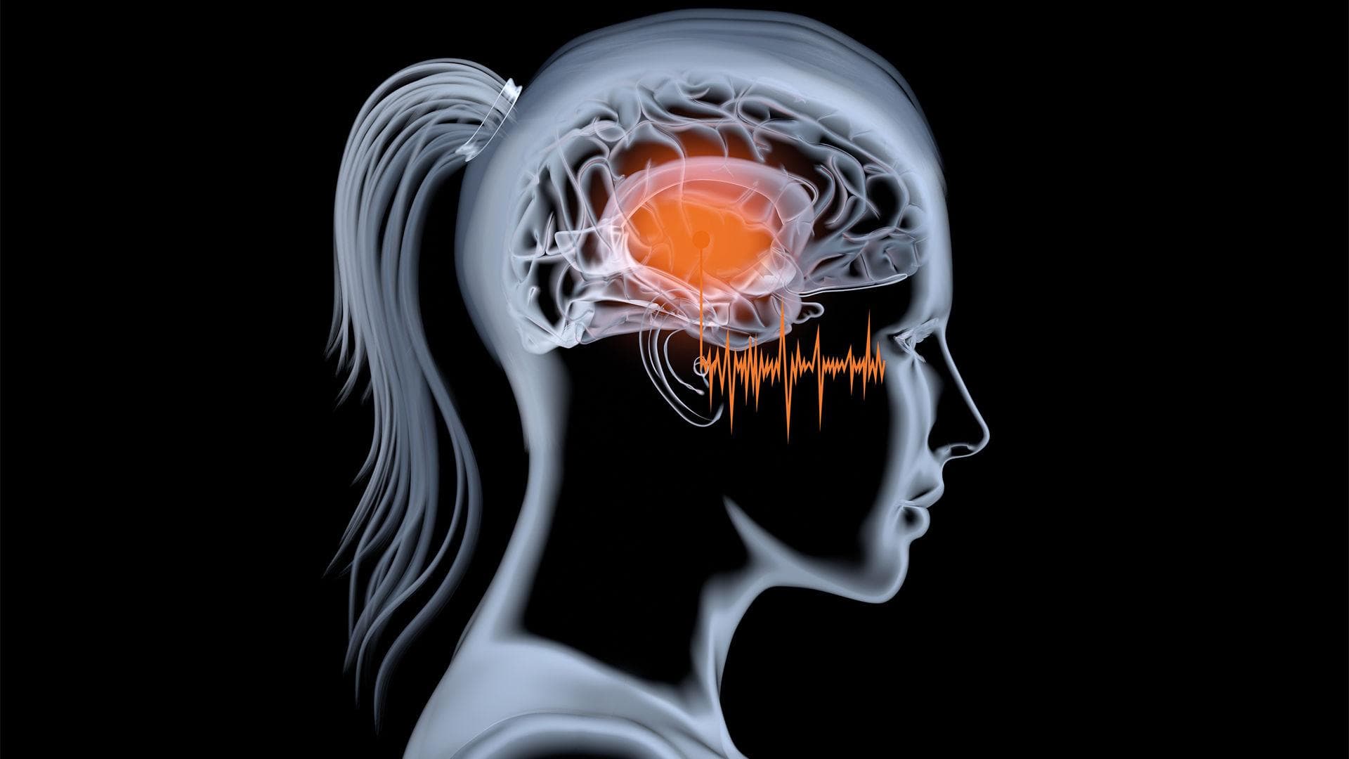 tinnitus