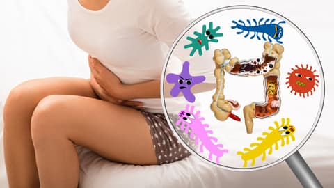 Morbus Crohn