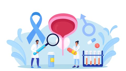 Prostatakrebs ist eine Krebserkrankung der Vorsteherdrüse des Mannes.