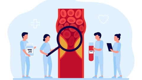 Grafik von Medizinern, die eine Thrombose untersuchen 