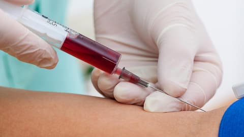 Person bekommt Eigenblut injeziert