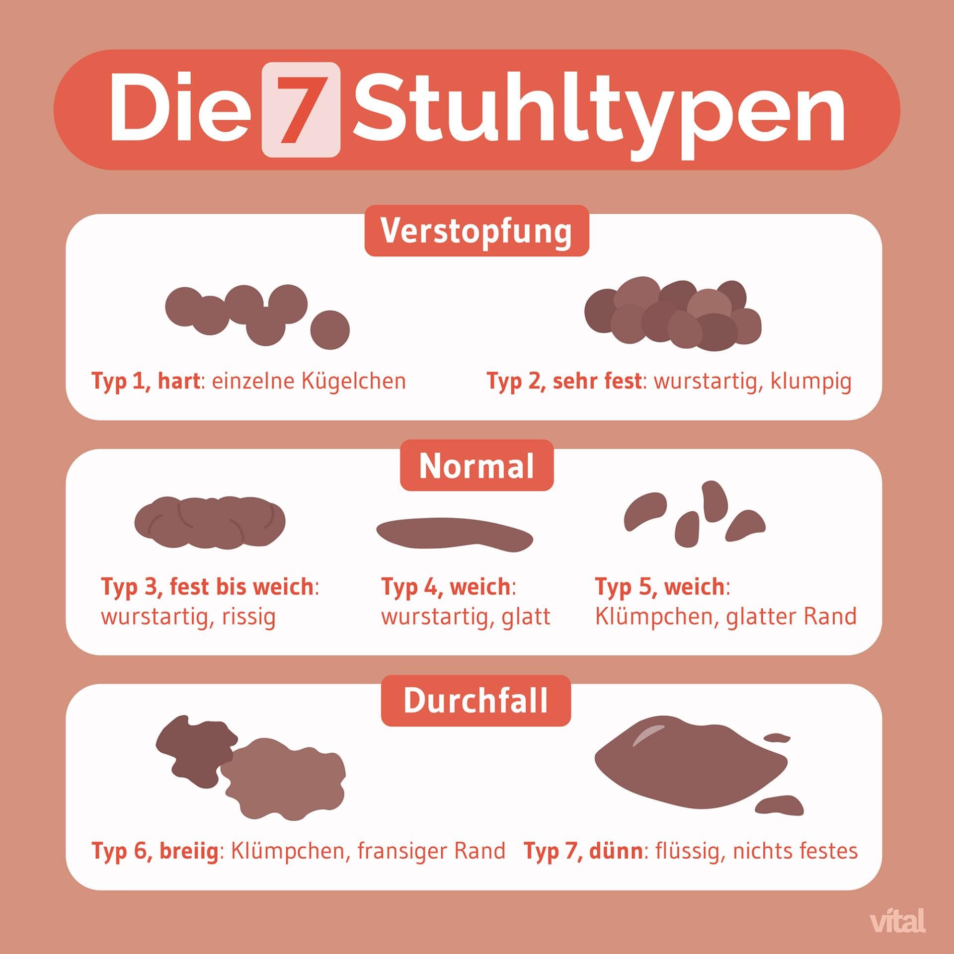 Grafik der 7 Stuhltypen Grafik der 7 Stuhltypen
