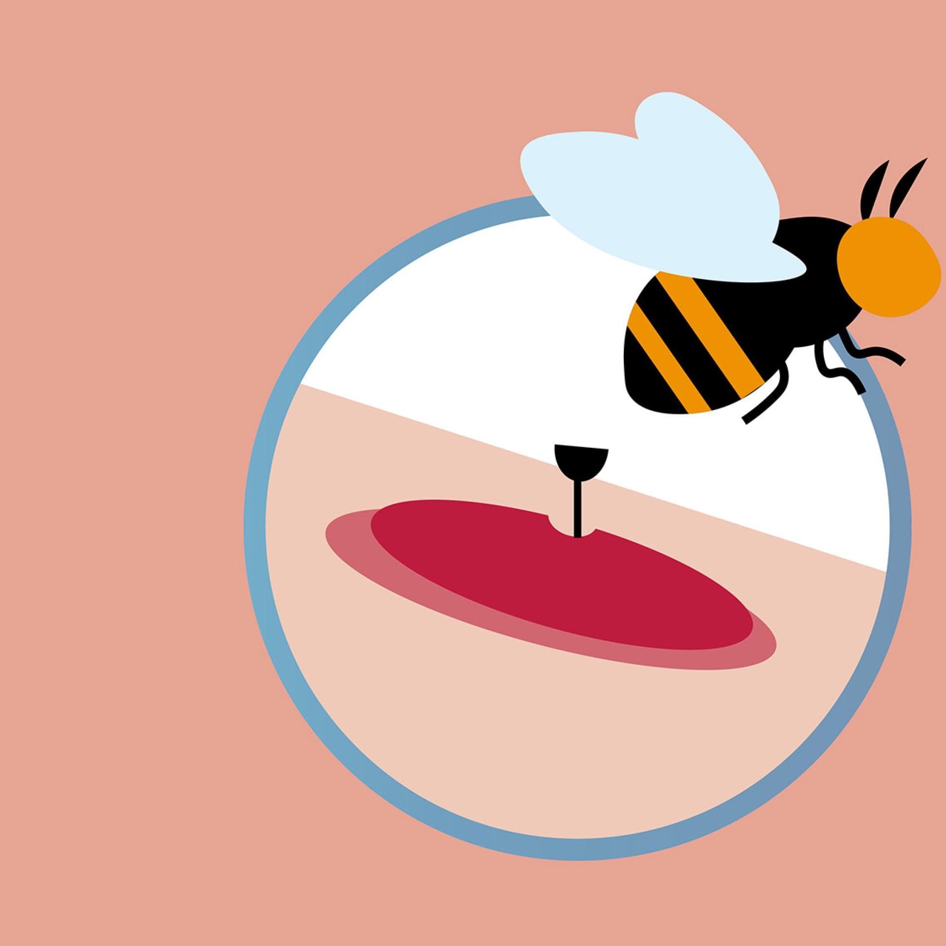 So erkennen Sie einen Bienenstich Darstellung eines Bienenstichs