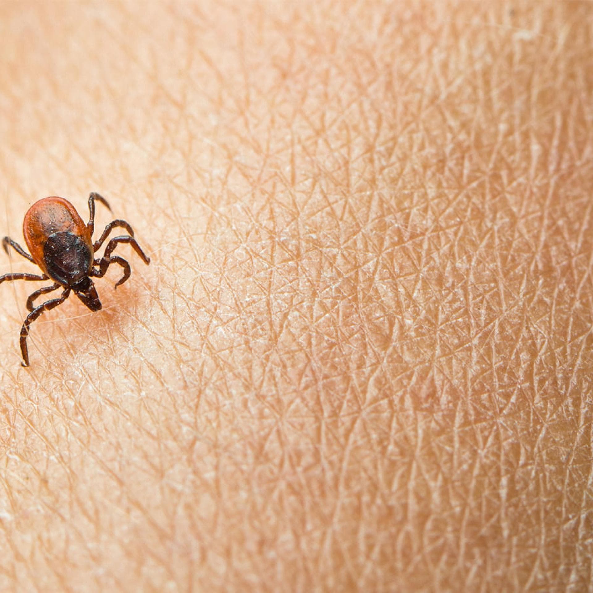 Borreliose vom Biss der Zecke