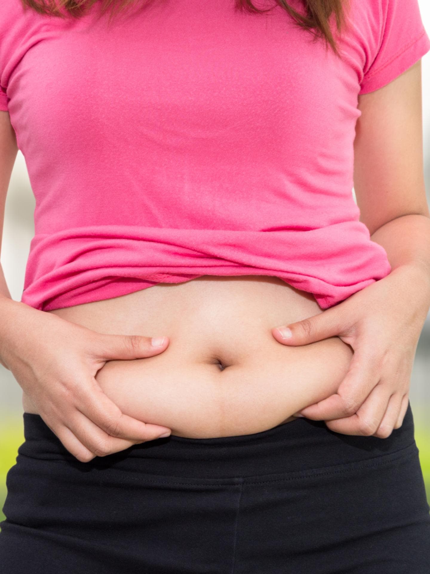 Speckfalte am Bauch einer Frau