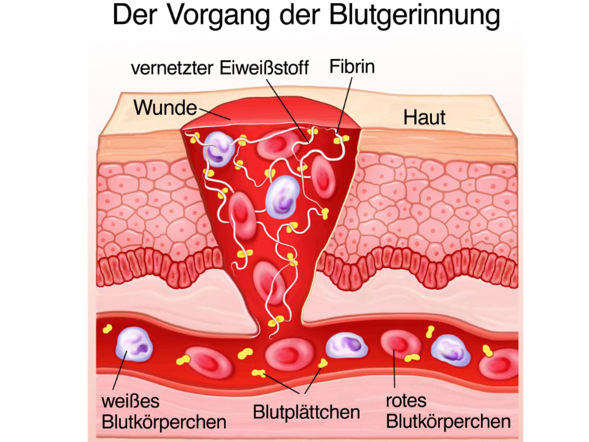 Grafik zum Vorgang der Blutgerinnung