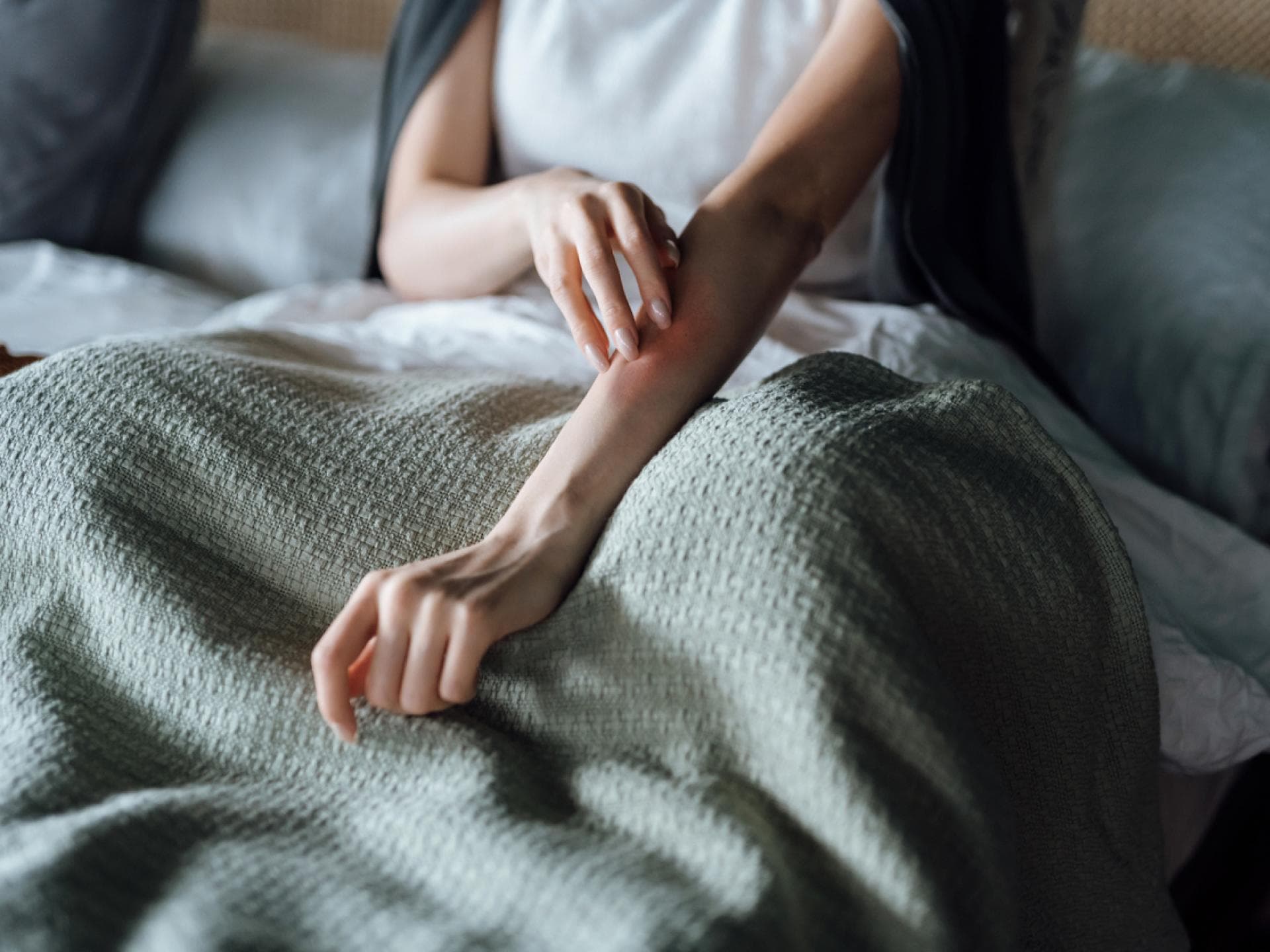 Frau mit juckendem Ausschlag am Arm