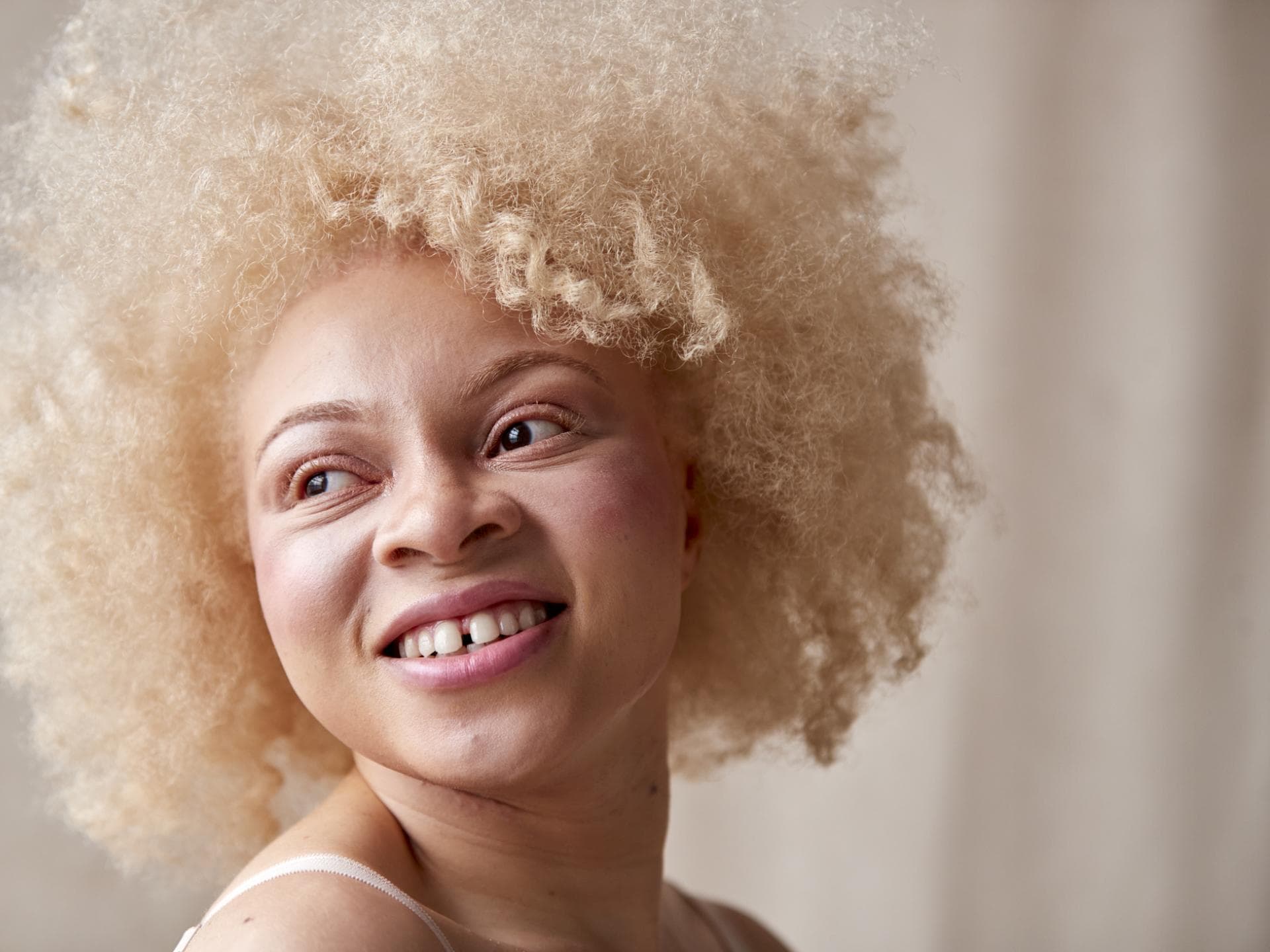 Albino Frau