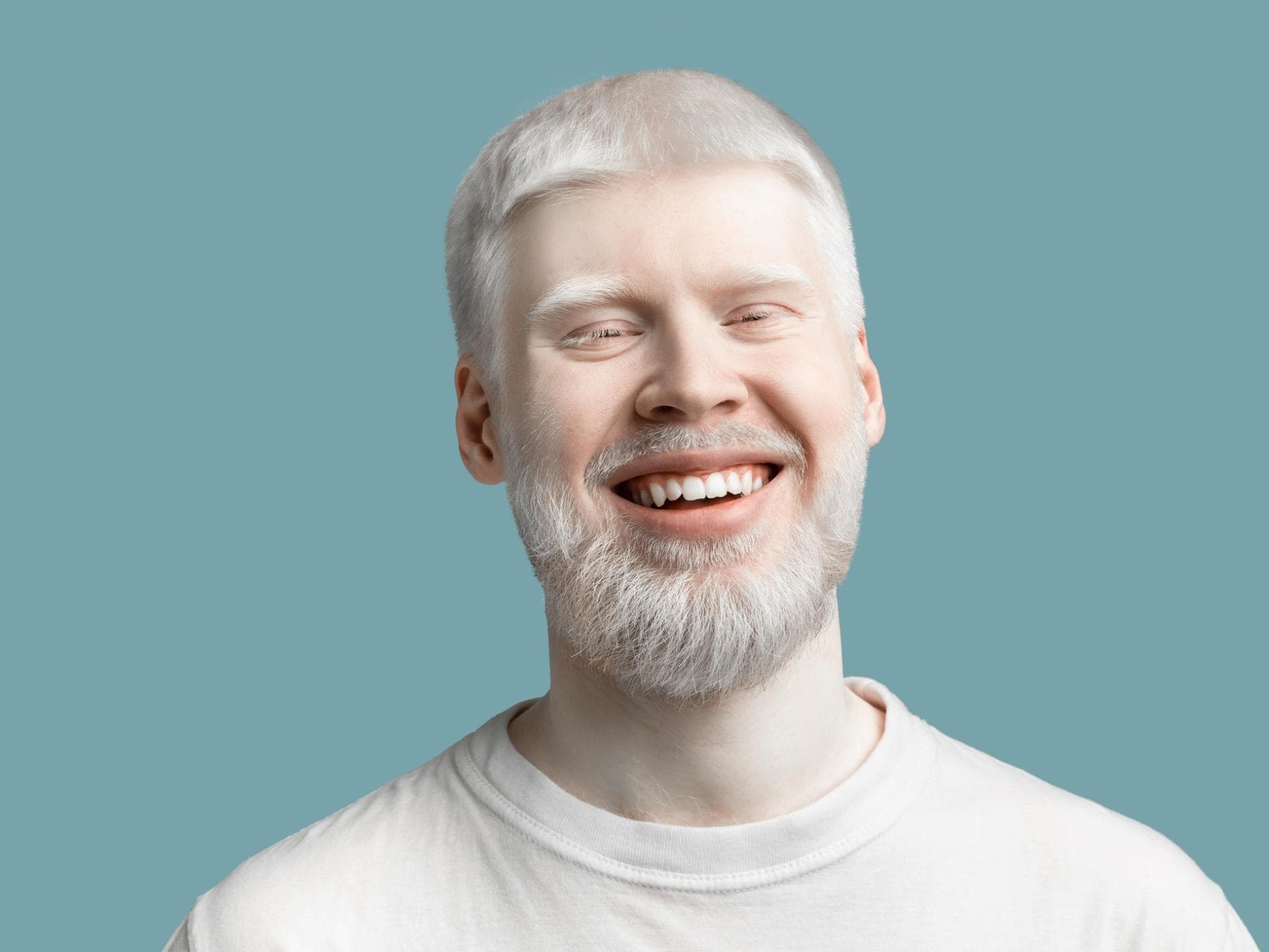 Mann mit Albinismus