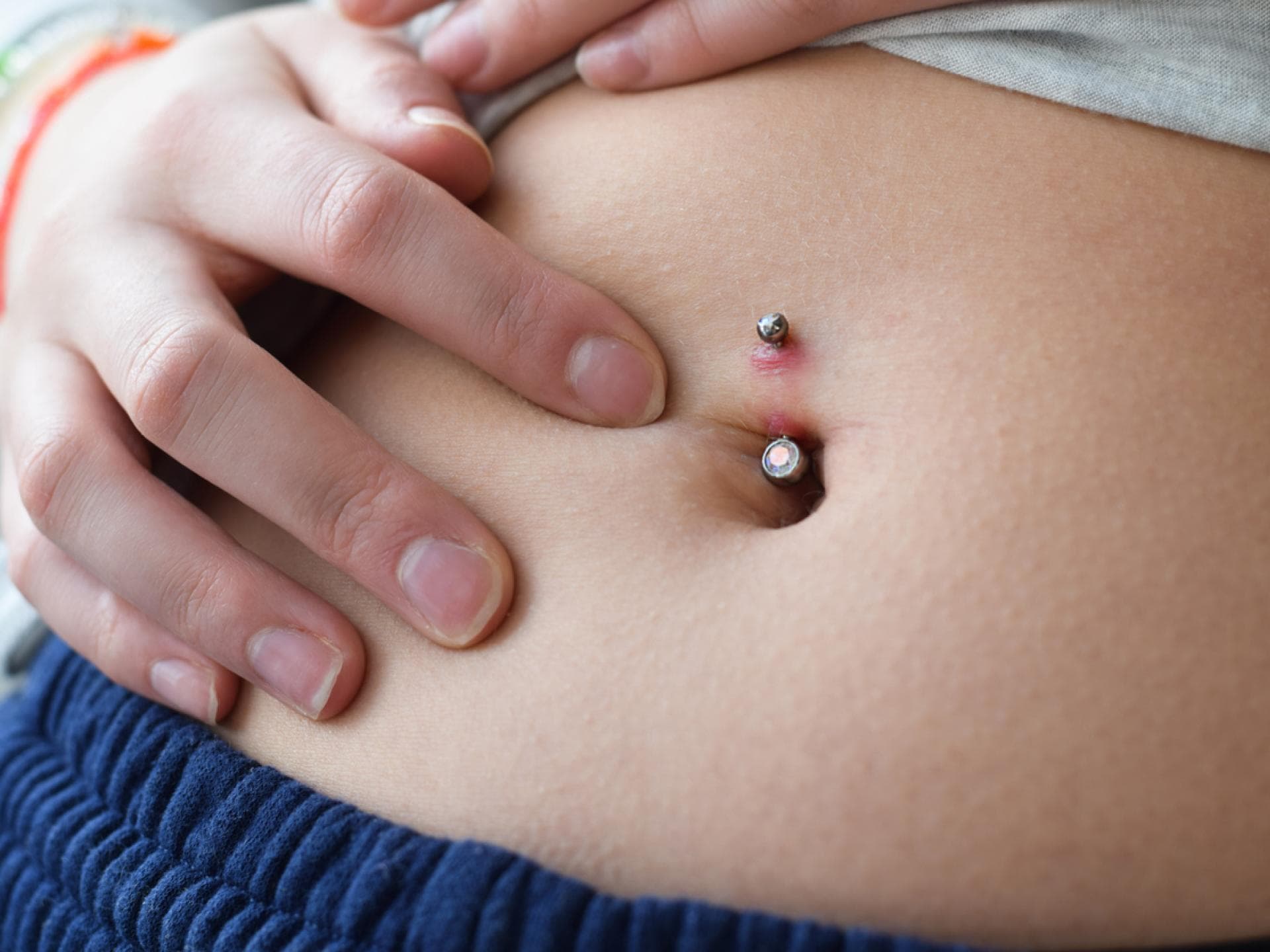 In manchen Fällen kommt es am Piercing zu sogenanntem Wildfleisch. In manchen Fällen kommt es am Piercing zu sogenanntem Wildfleisch.