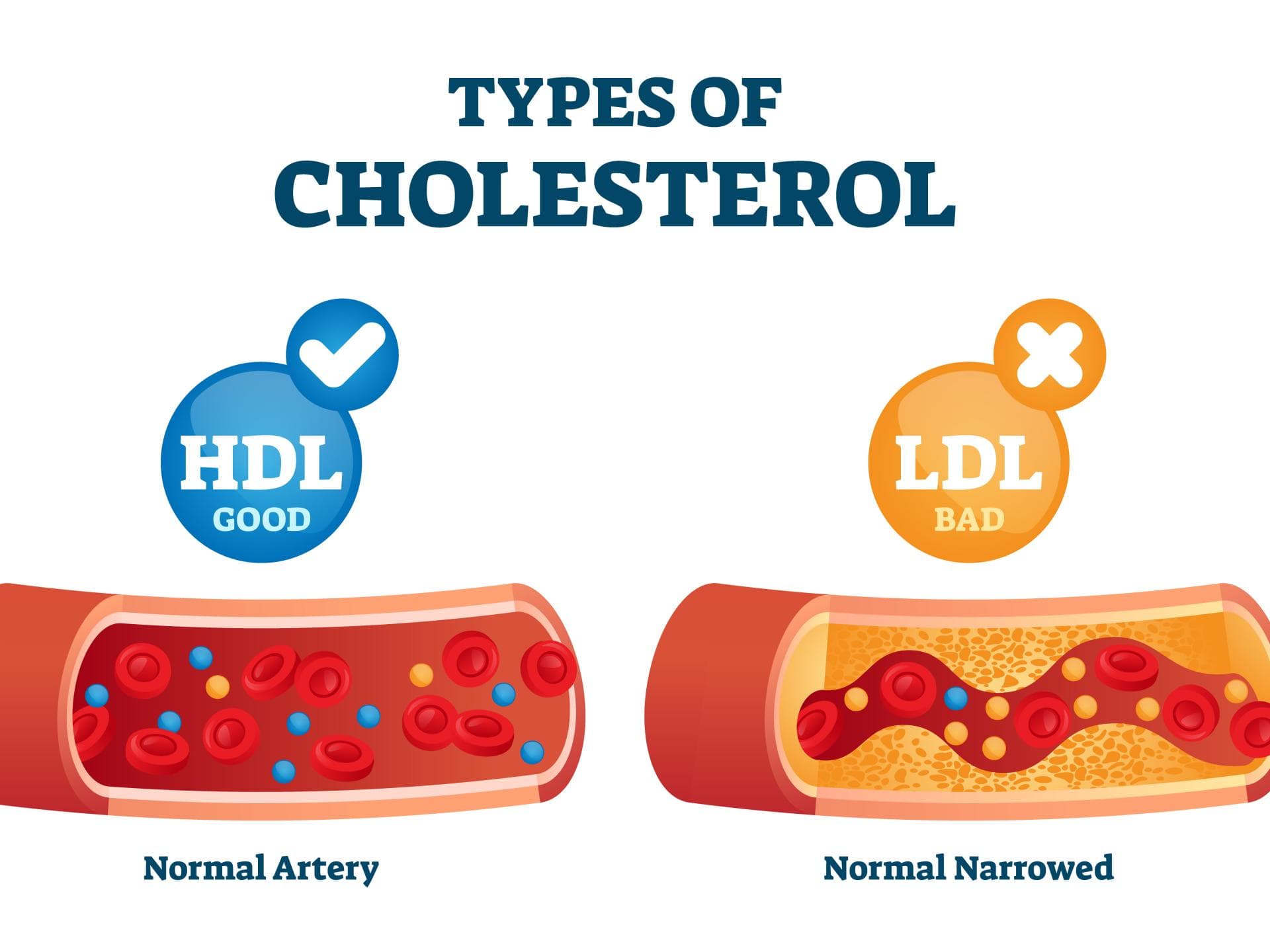 HDL Cholesterin und LDL Cholesterin im Vergleich