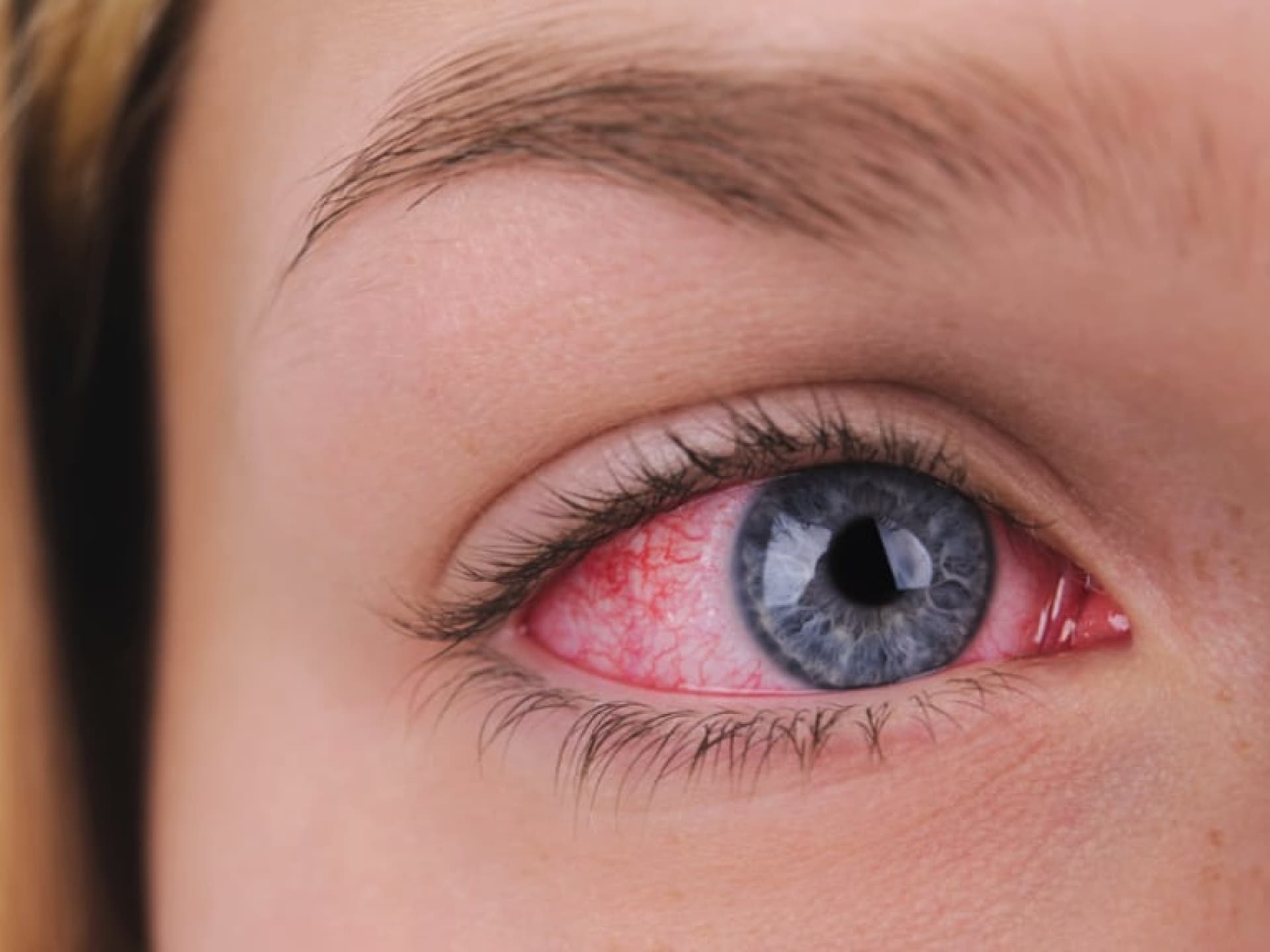 Rote Augen nach dem Schlafen Frau mit geröteten Augen